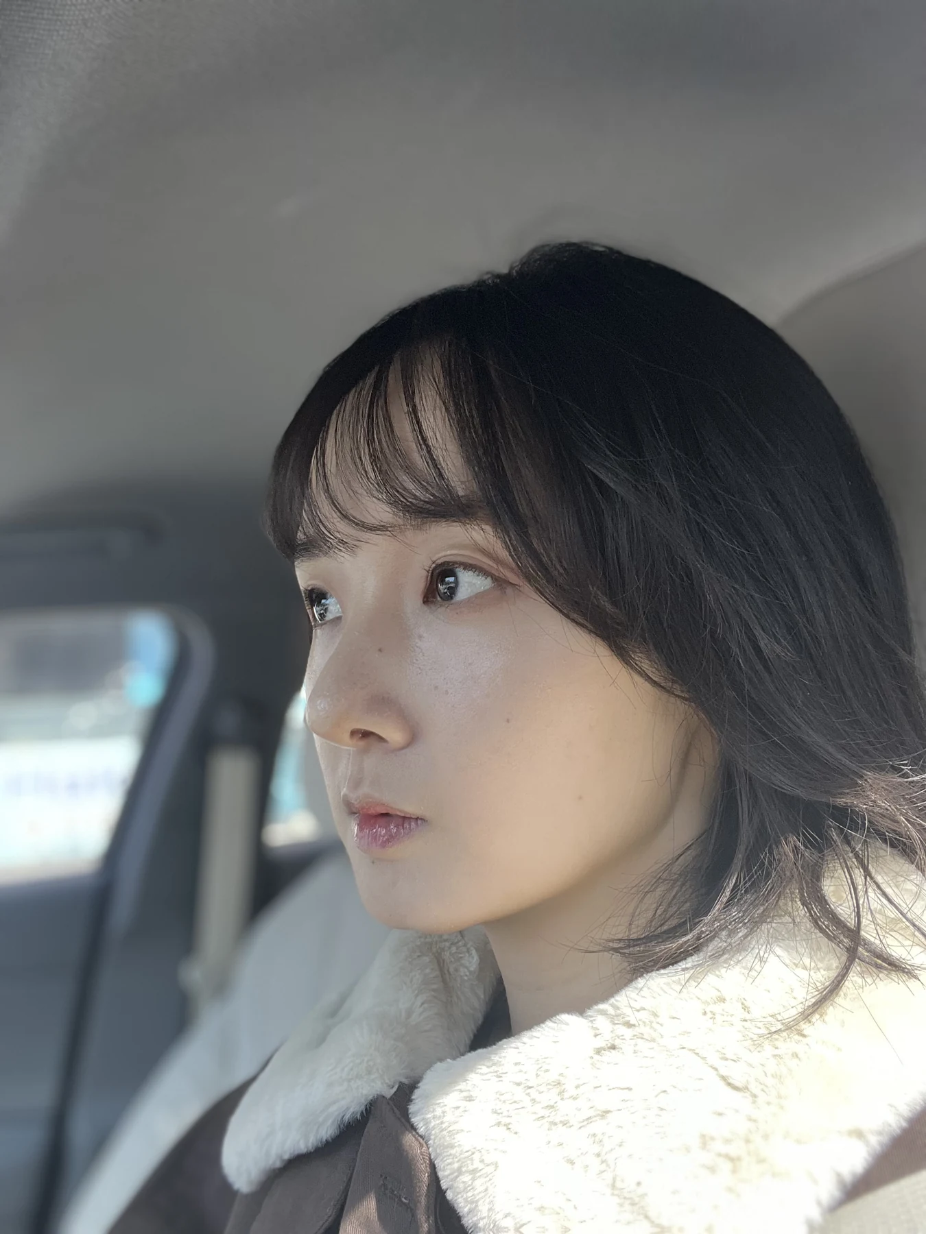 Eyelid surgery: three-month recovery and an asymmetry concern · Case 087 at Answer Plastic Surgery. Opposite oblique view — 1 month after surgery, eyelid surgery at Answer Plastic Surgery (case 087).