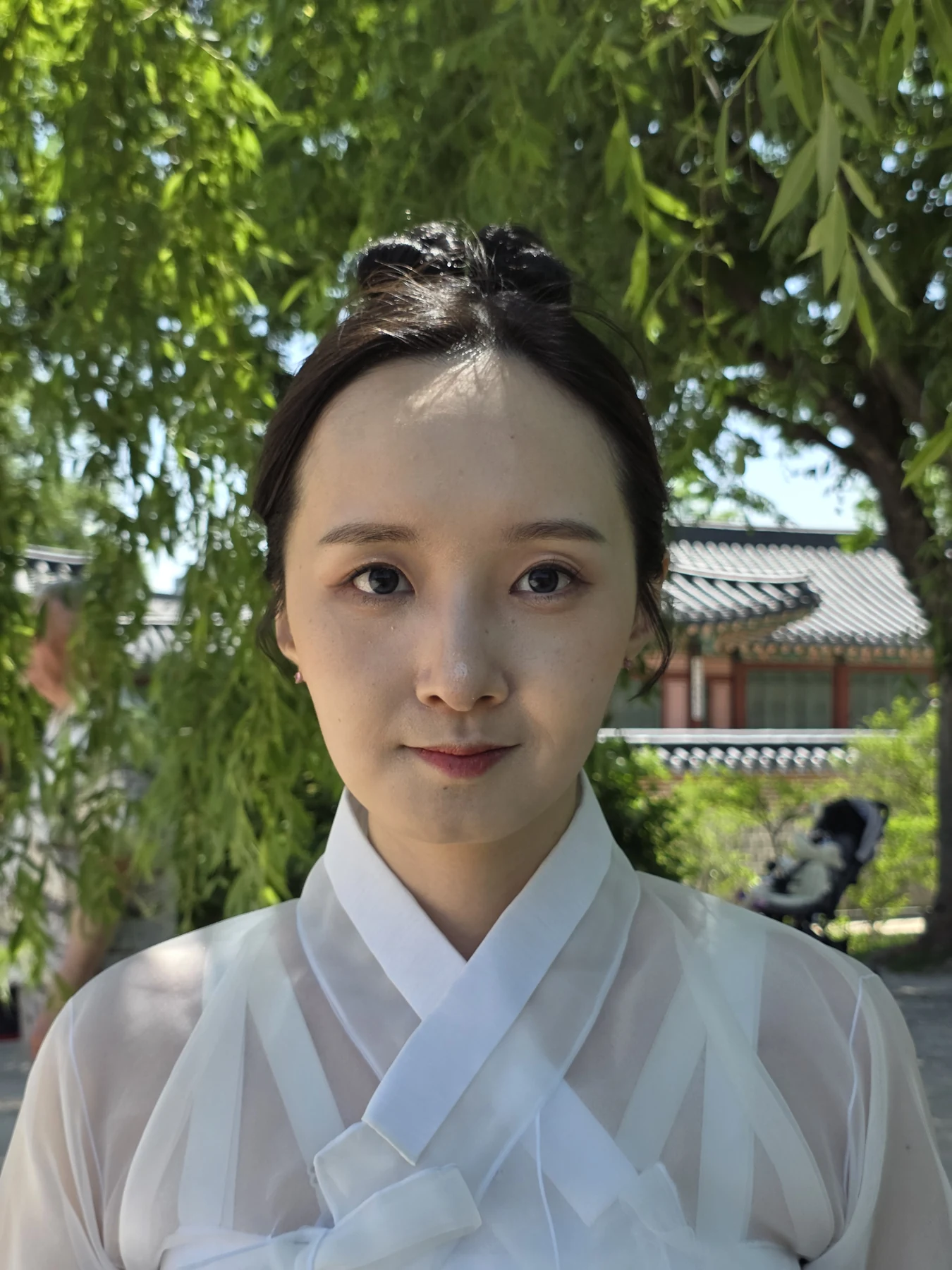 Eyelid surgery: three-month recovery and an asymmetry concern · Case 087 at Answer Plastic Surgery. Front view — 3 months after surgery, eyelid surgery at Answer Plastic Surgery (case 087).