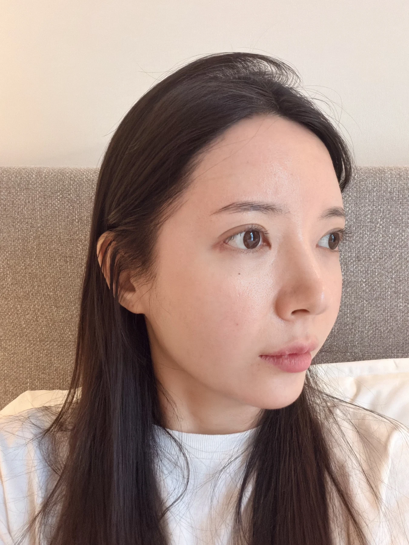 Eye-area surgery: recovery from surgery day to one month · Case 090 at Answer Plastic Surgery. Opposite oblique view — 3 weeks after surgery, eye-area surgery at Answer Plastic Surgery (case 090).