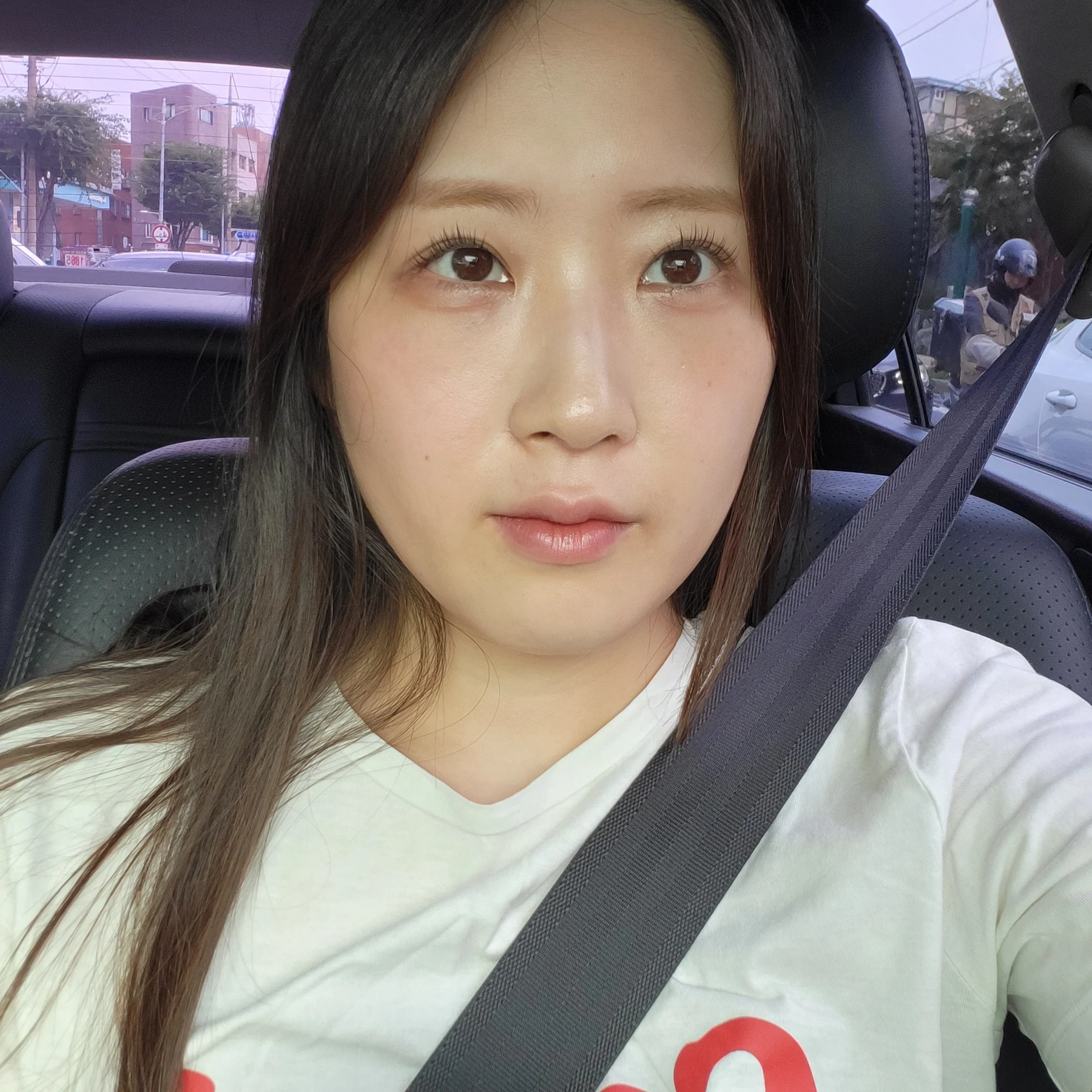 Eye-area surgery: patient observations through three months · Case 092 at Answer Plastic Surgery. Front view — 2 months after surgery, eye-area surgery at Answer Plastic Surgery (case 092).