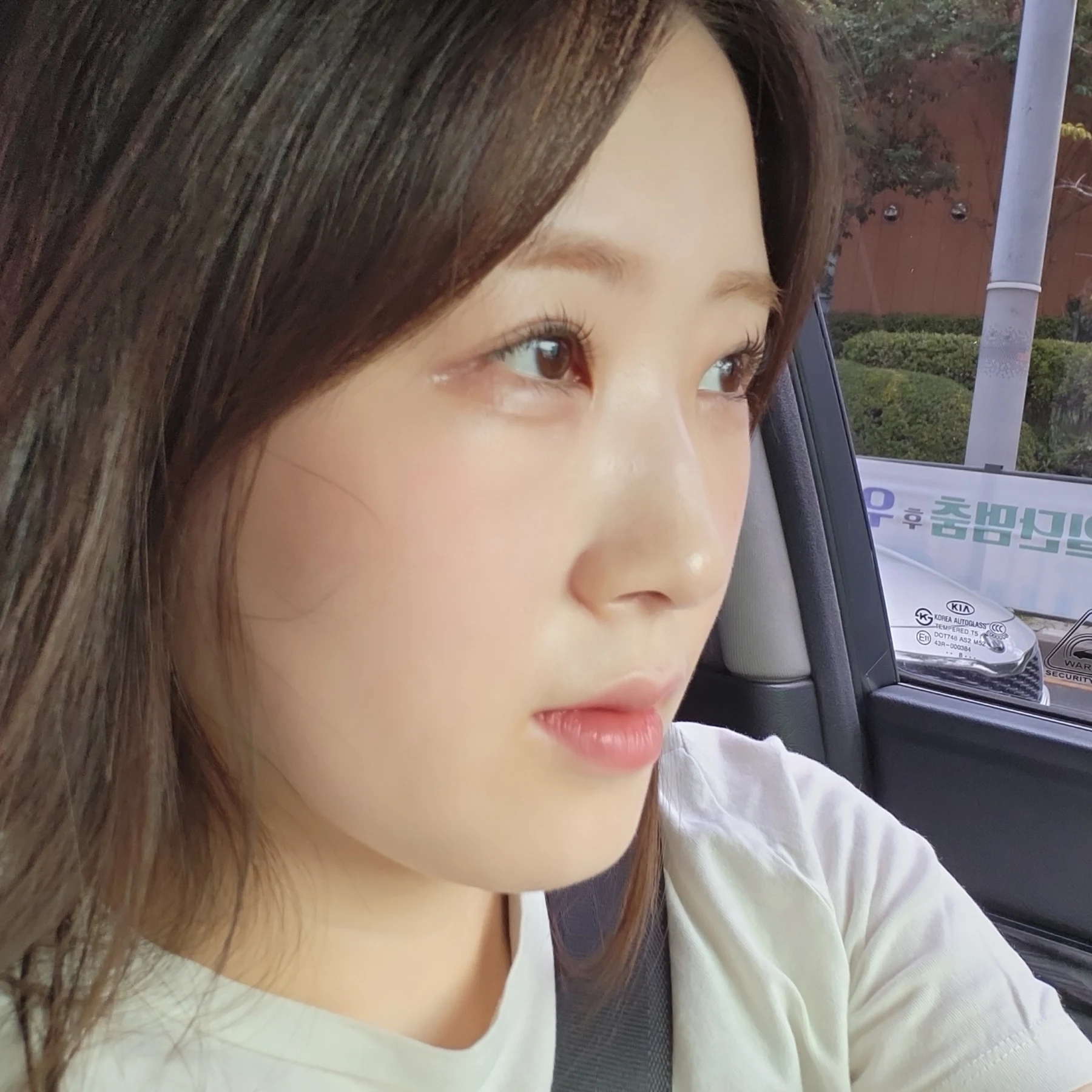 Eye-area surgery: patient observations through three months · Case 092 at Answer Plastic Surgery. Oblique view — 2 months after surgery, eye-area surgery at Answer Plastic Surgery (case 092).