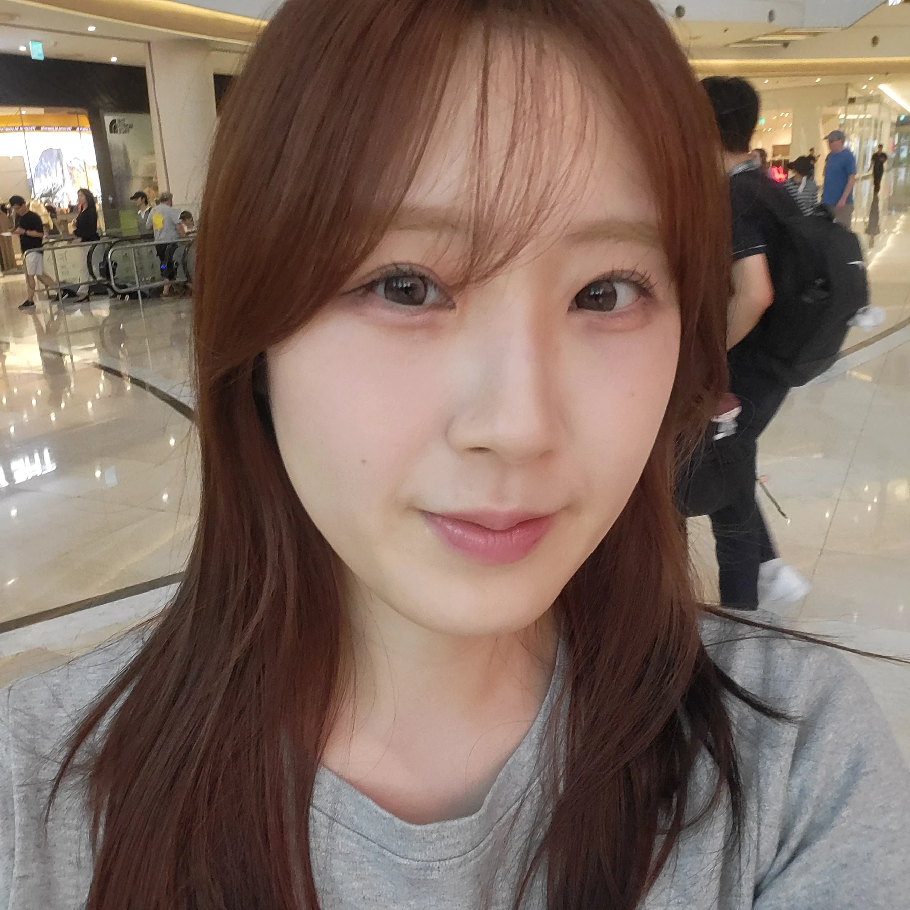 Eye-area surgery: patient observations through three months · Case 092 at Answer Plastic Surgery. Front view — 3 months after surgery, eye-area surgery at Answer Plastic Surgery (case 092).