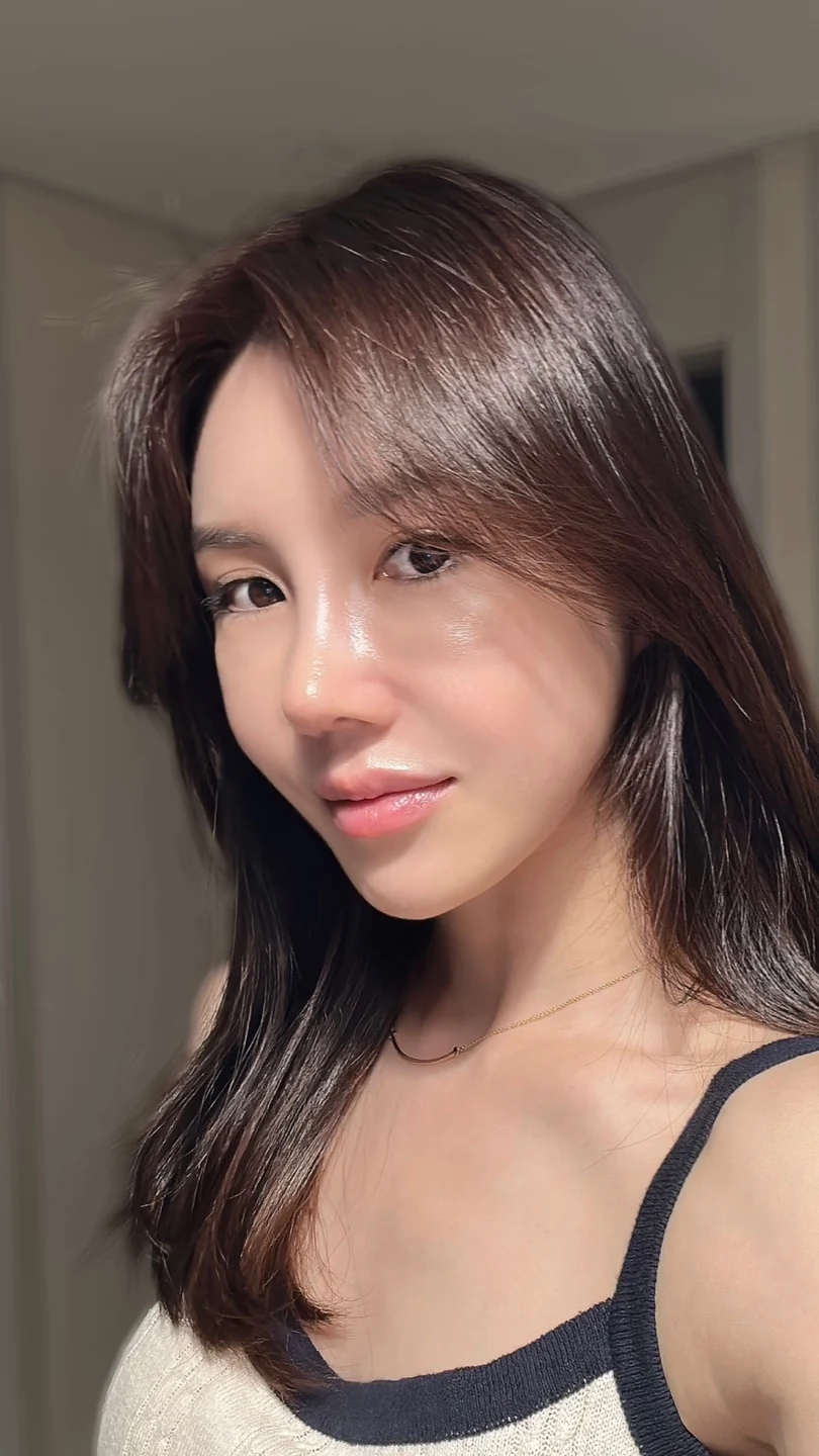Rib-cartilage rhinoplasty: recovery through six months · Case 022 at Answer Plastic Surgery. Oblique view after rhinoplasty — 1 month at Answer Plastic Surgery.