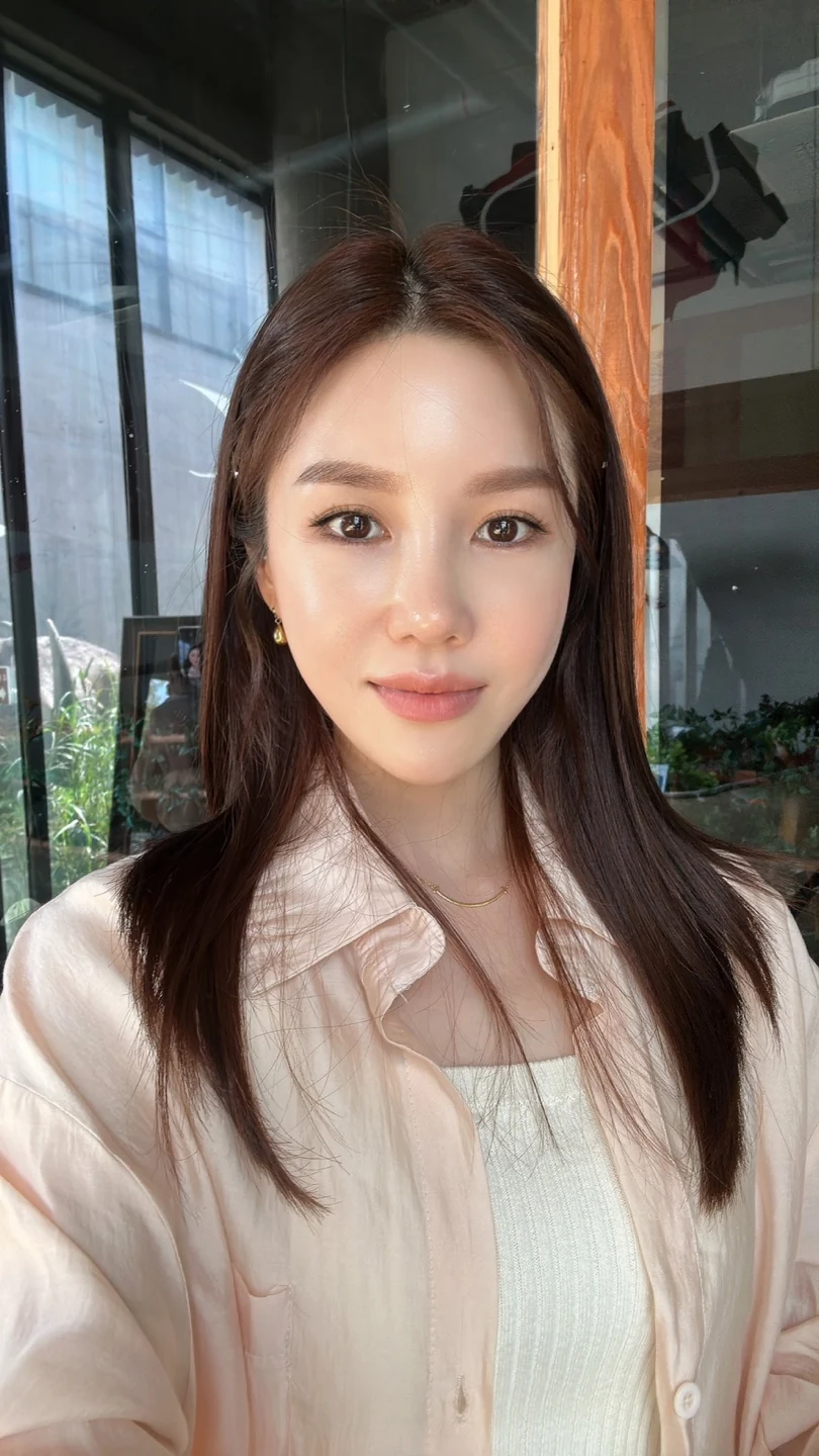 Rib-cartilage rhinoplasty: recovery through six months · Case 022 at Answer Plastic Surgery. Front view after rhinoplasty — 2 months at Answer Plastic Surgery.