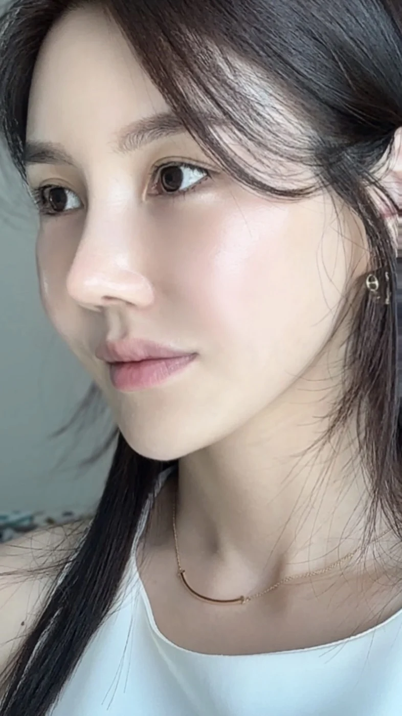Rib-cartilage rhinoplasty: recovery through six months · Case 022 at Answer Plastic Surgery. Oblique view after rhinoplasty — 3 months at Answer Plastic Surgery.