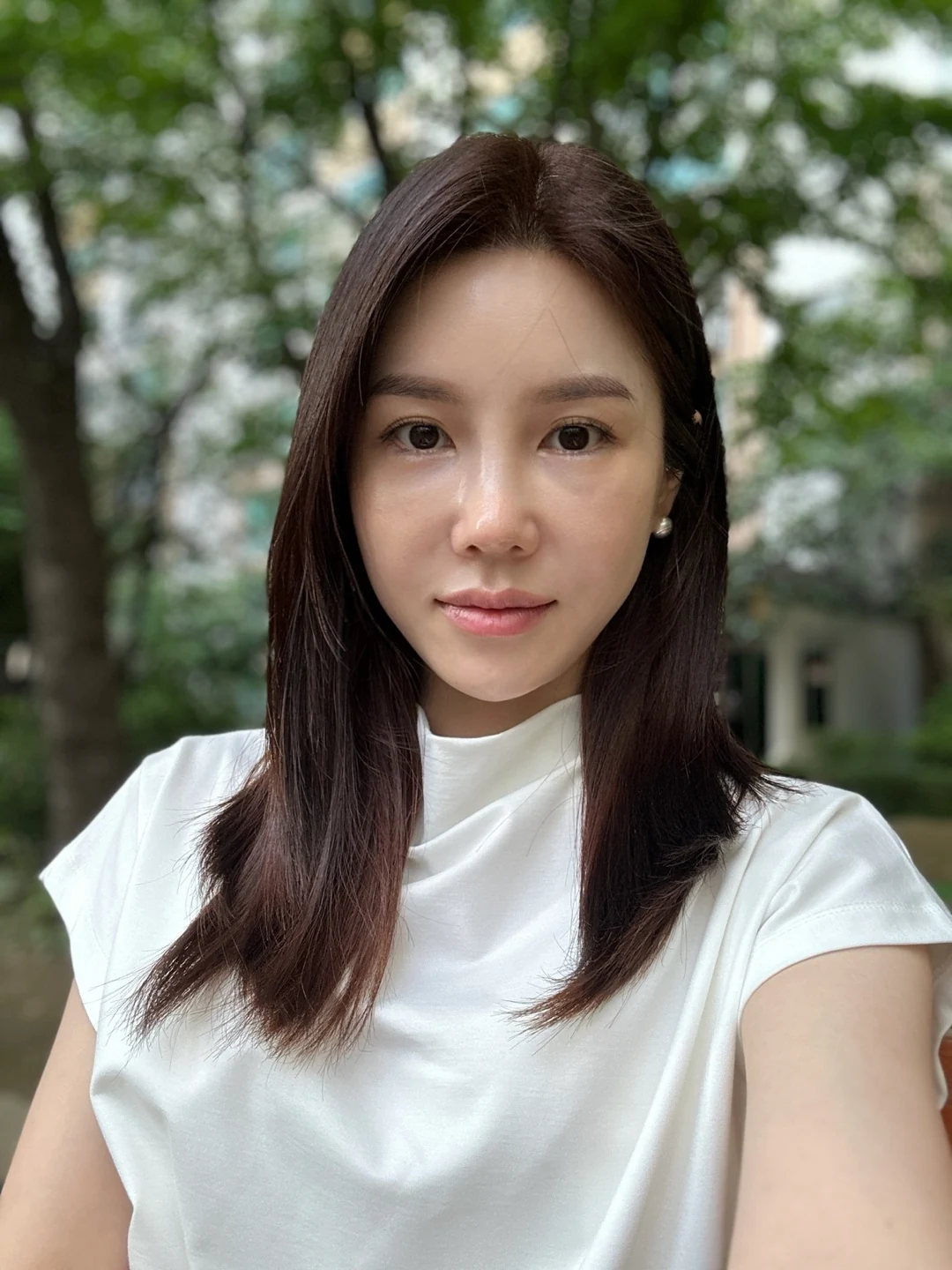Rib-cartilage rhinoplasty: recovery through six months · Case 022 at Answer Plastic Surgery. Front view during rhinoplasty recovery — 3 weeks at Answer Plastic Surgery.
