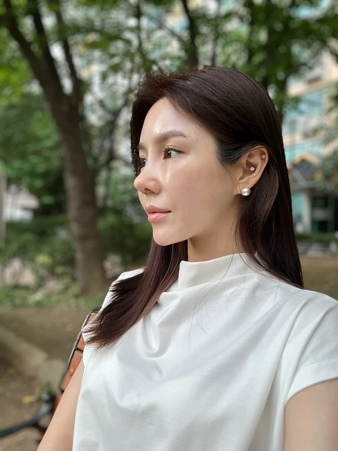 Rib-cartilage rhinoplasty: recovery through six months · Case 022 at Answer Plastic Surgery. Oblique view during rhinoplasty recovery — 3 weeks at Answer Plastic Surgery.