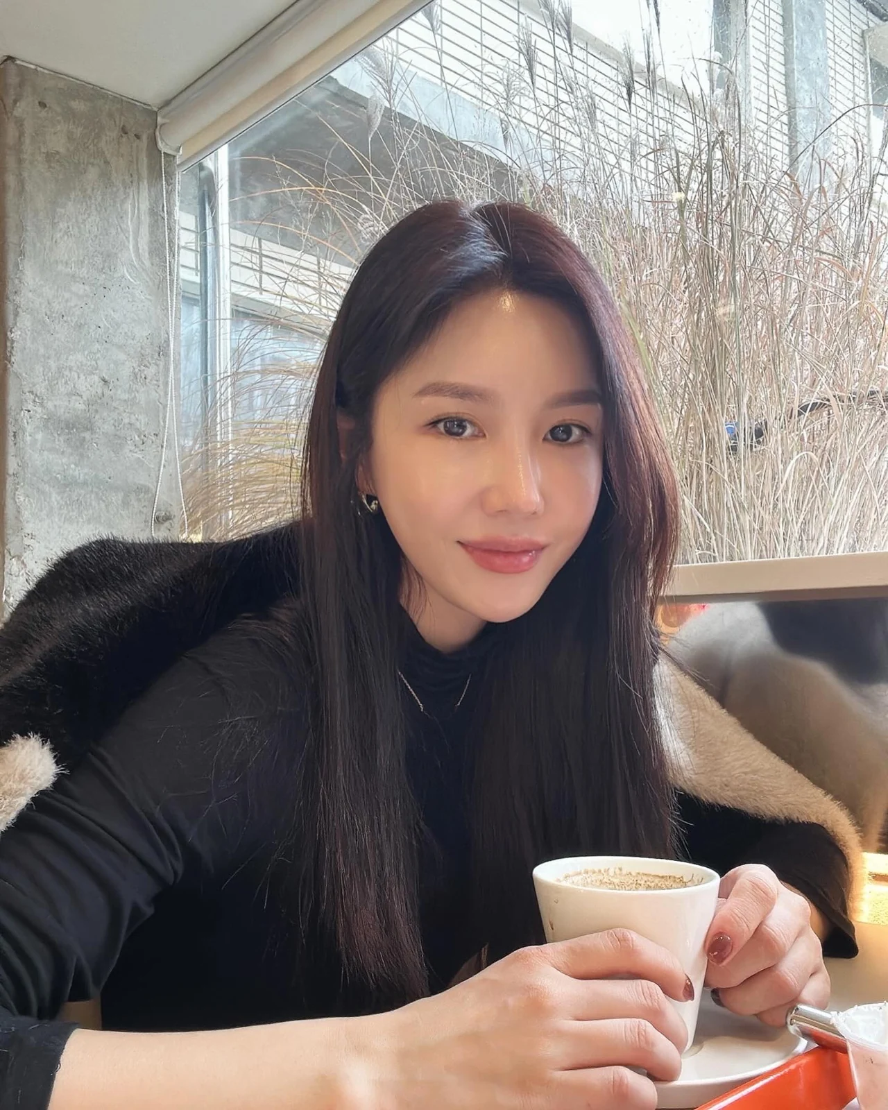 Rib-cartilage rhinoplasty: recovery through six months · Case 022 at Answer Plastic Surgery. Later front-facing photograph after rhinoplasty — 6 months at Answer Plastic Surgery.
