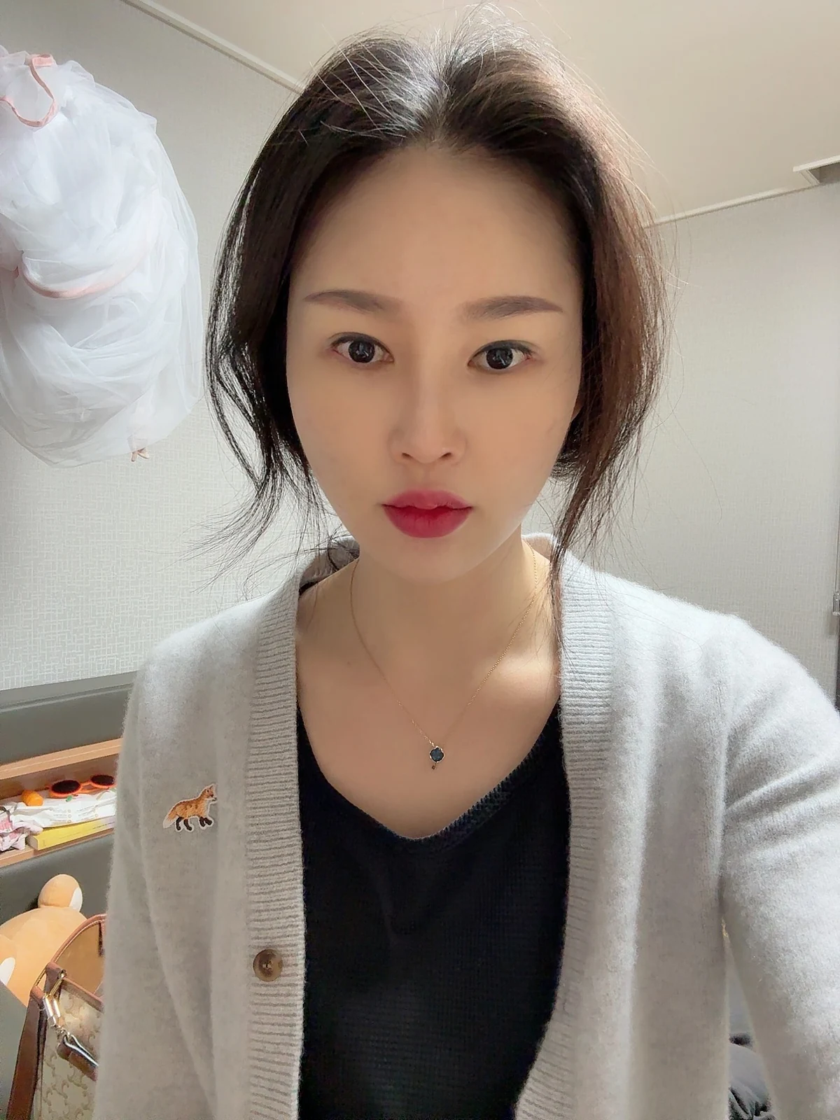 Revision double-eyelid surgery and Wonder canthoplasty: three-month follow-up · Case 043 at Answer Plastic Surgery. Three months: front view of the eye area, supplied by Answer Plastic Surgery for case ANS-043.