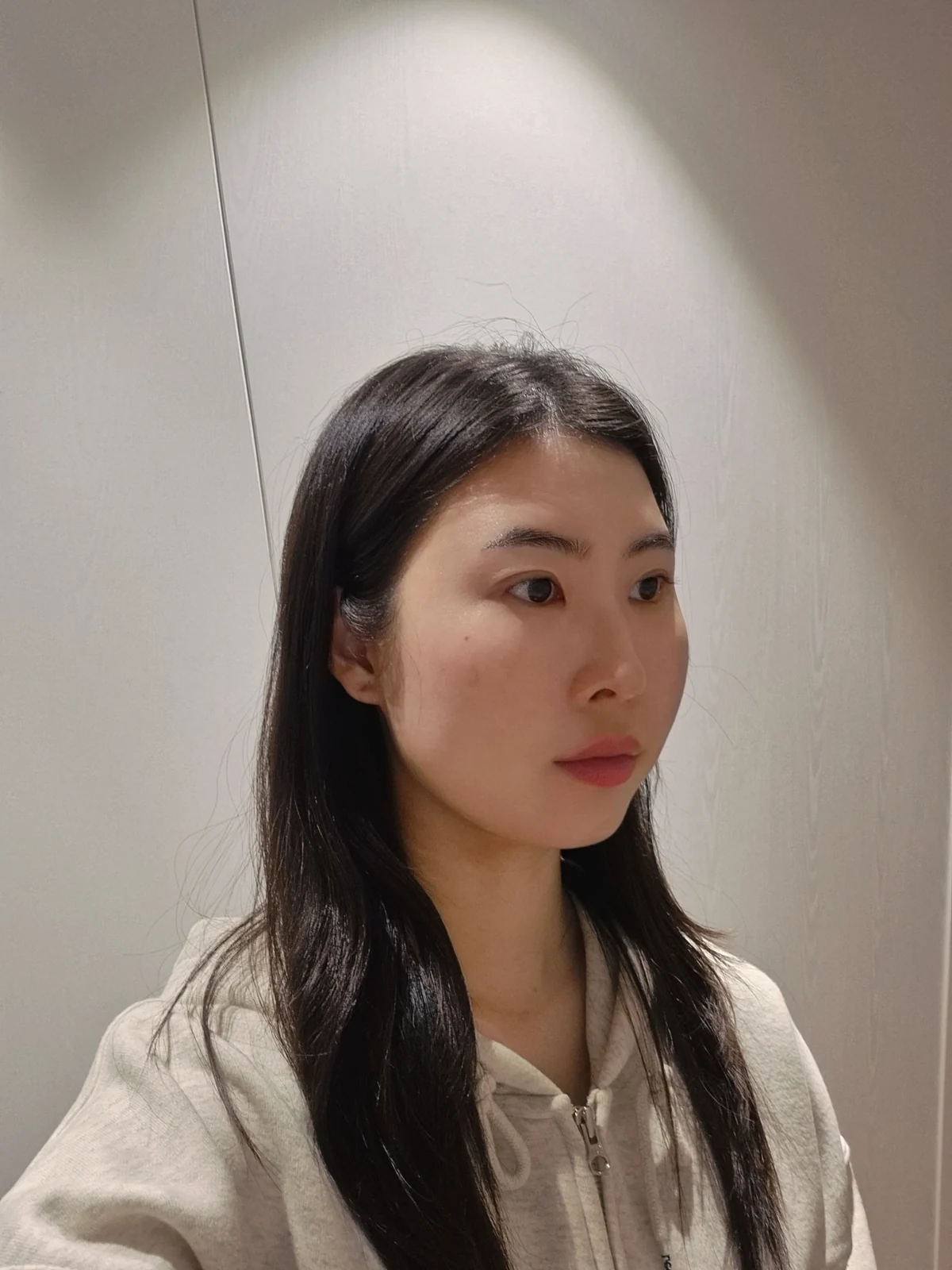 Double-eyelid surgery with canthoplasty and ptosis correction: two-month sequence · Case 044 at Answer Plastic Surgery. One month: angled view of the eye area, supplied by Answer Plastic Surgery for case ANS-044.