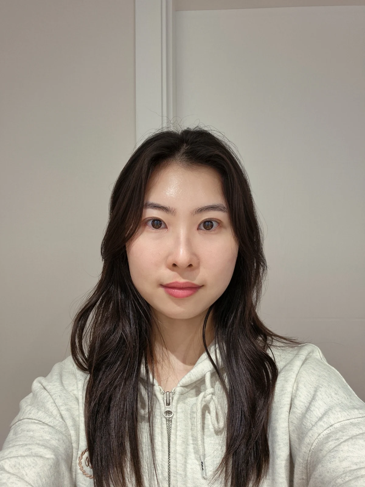 Double-eyelid surgery with canthoplasty and ptosis correction: two-month sequence · Case 044 at Answer Plastic Surgery. One month: front view of the eye area, supplied by Answer Plastic Surgery for case ANS-044.