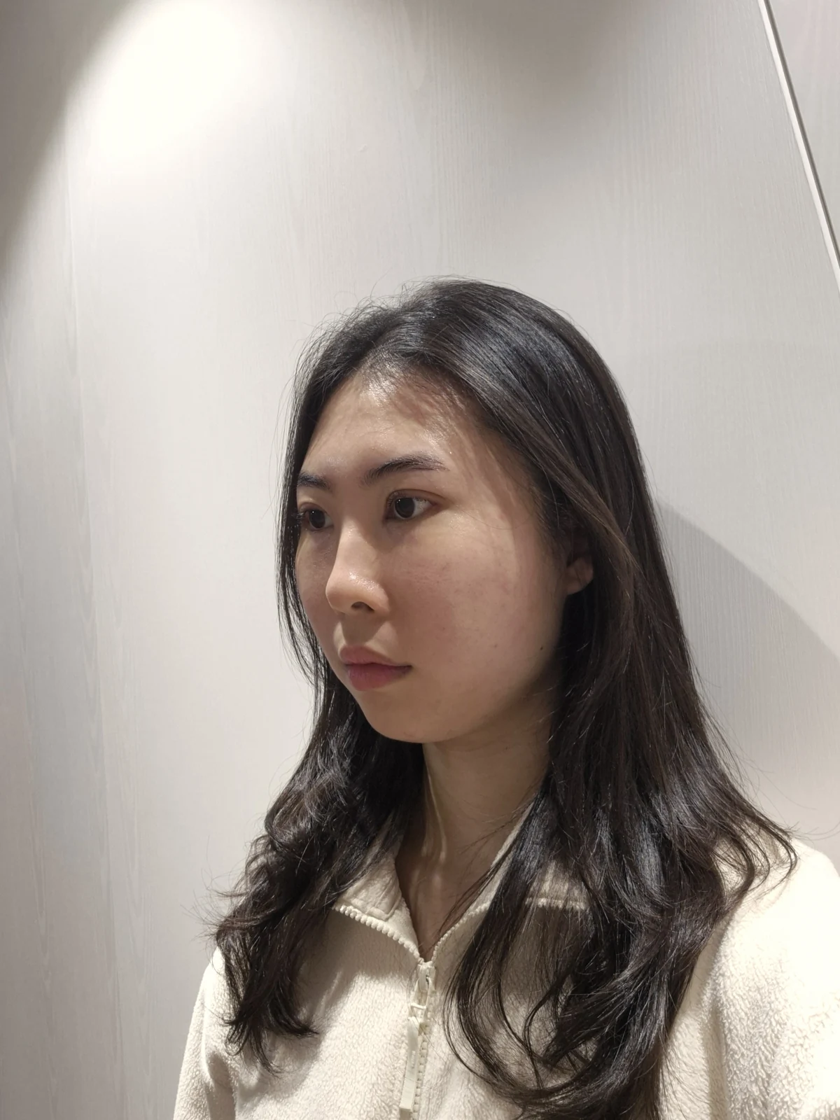 Double-eyelid surgery with canthoplasty and ptosis correction: two-month sequence · Case 044 at Answer Plastic Surgery. One week: angled view of the eye area, supplied by Answer Plastic Surgery for case ANS-044.