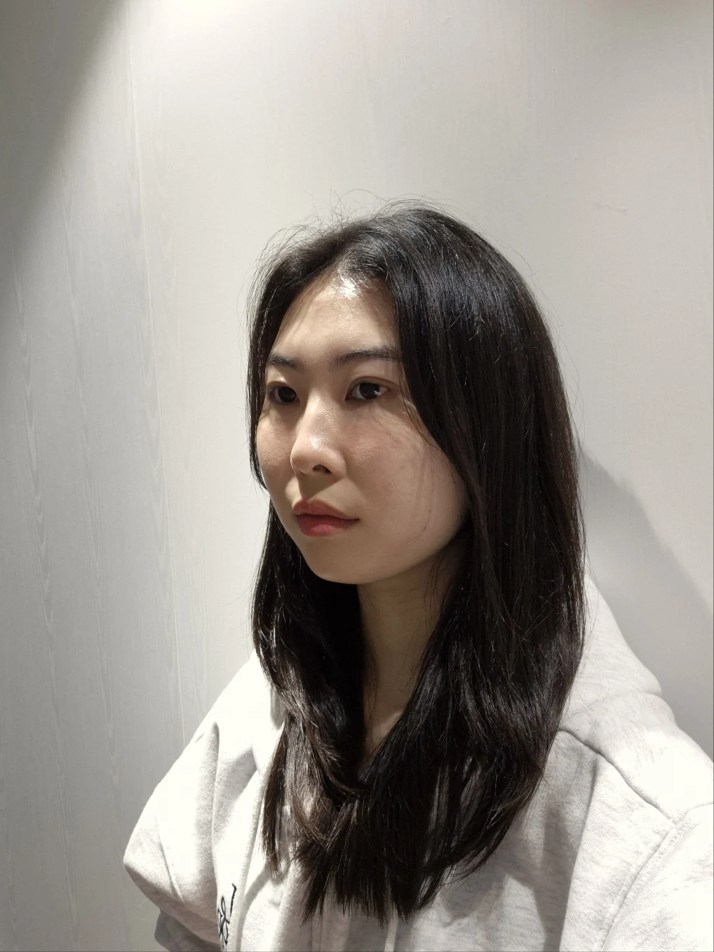 Double-eyelid surgery with canthoplasty and ptosis correction: two-month sequence · Case 044 at Answer Plastic Surgery. Two months: angled view of the eye area, supplied by Answer Plastic Surgery for case ANS-044.
