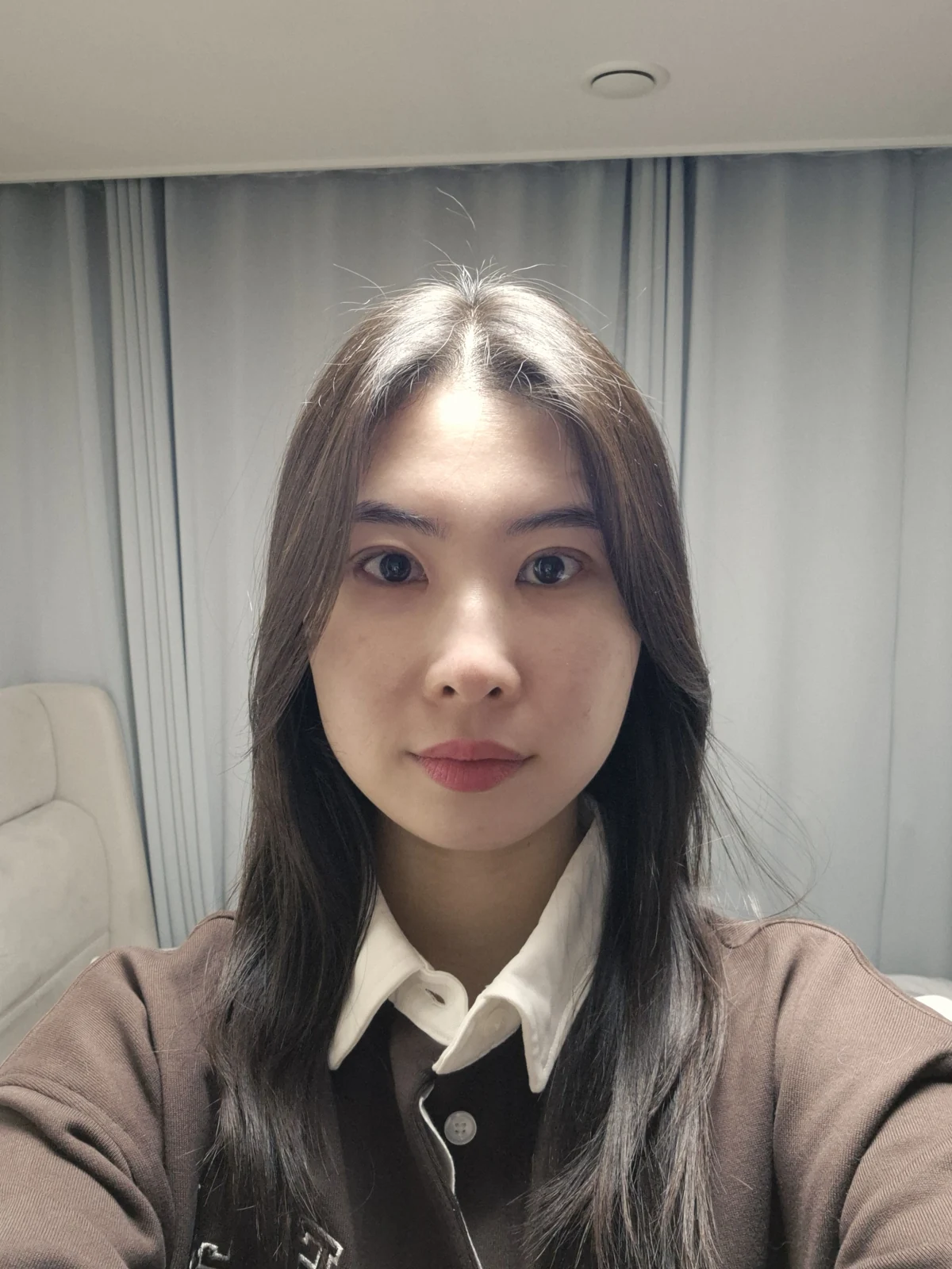 Double-eyelid surgery with canthoplasty and ptosis correction: two-month sequence · Case 044 at Answer Plastic Surgery. Three weeks: front view of the eye area, supplied by Answer Plastic Surgery for case ANS-044.