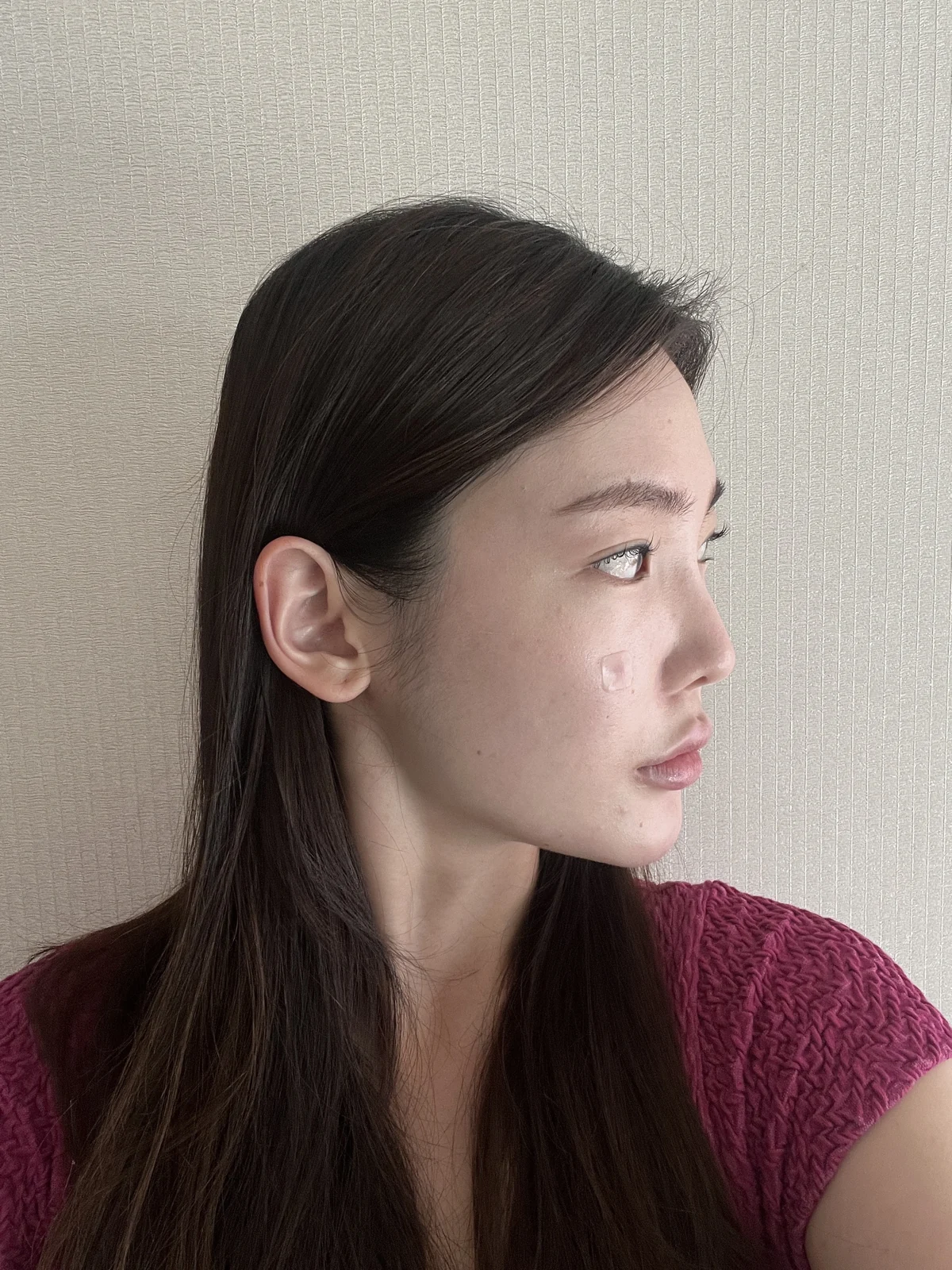 Facial before-and-after photographs through two months · Case 023 at Answer Plastic Surgery. Opposite oblique view of the face — before at Answer Plastic Surgery.