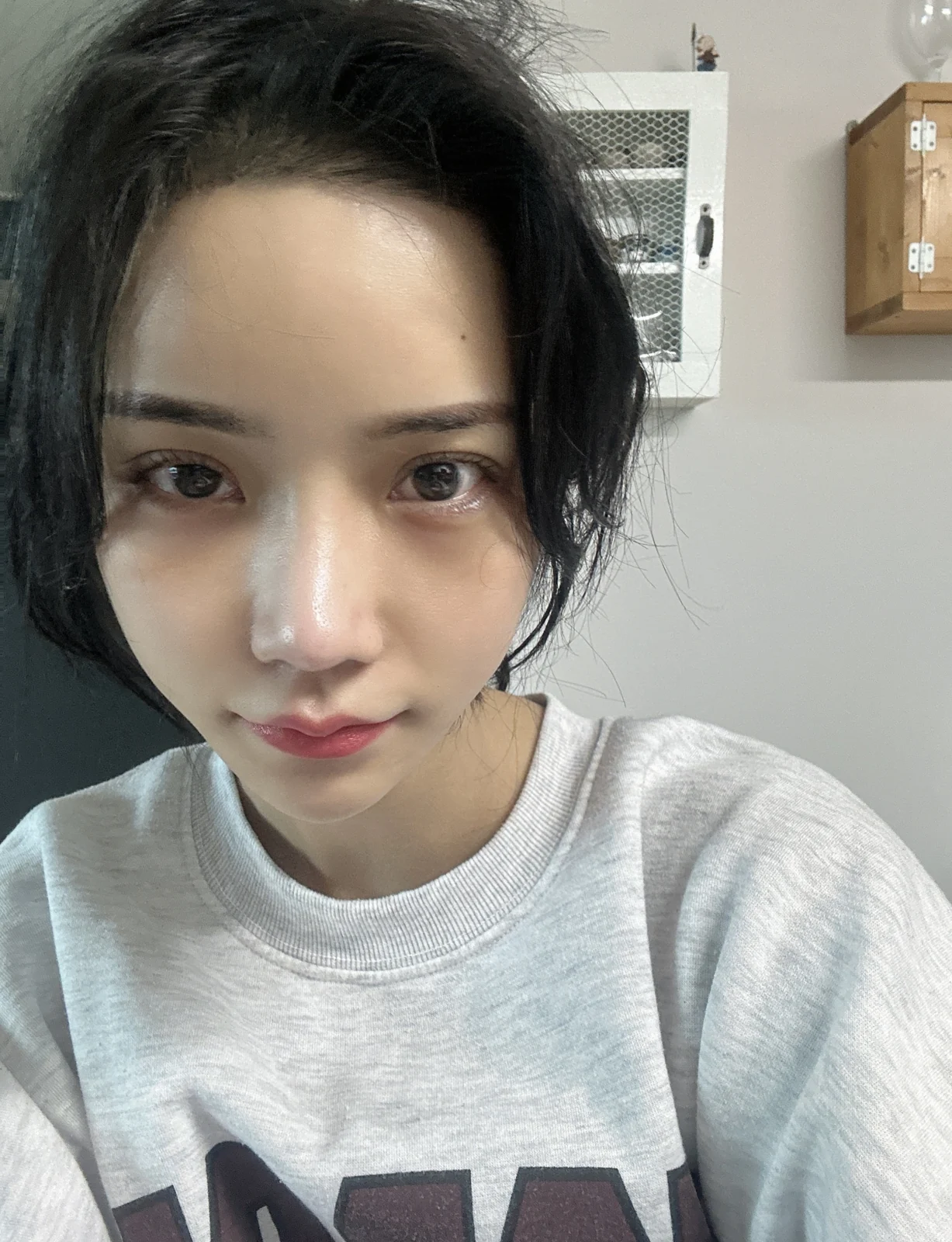 Rhinoplasty and eye surgery: a two-month photo diary · Case 024 at Answer Plastic Surgery. Front view after combined surgery — 1 month at Answer Plastic Surgery.