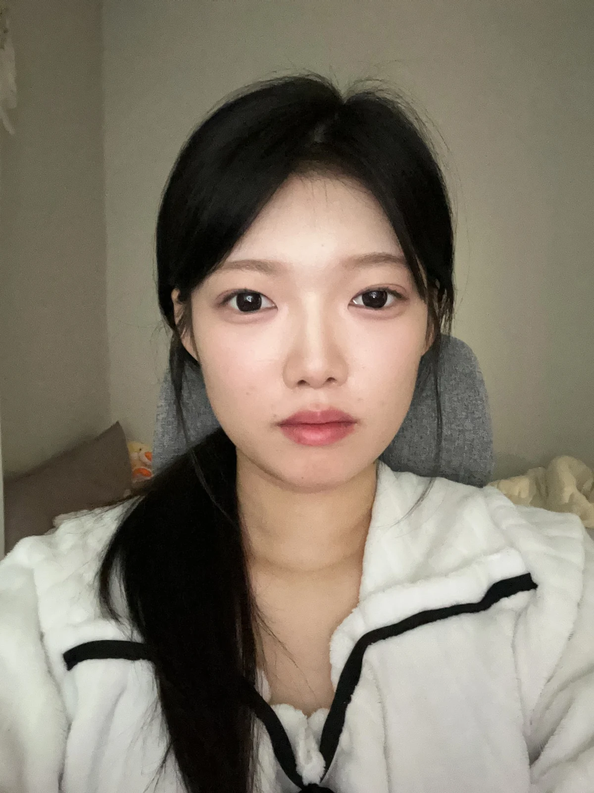 Non-incisional eyelid surgery: first three weeks · Case 048 at Answer Plastic Surgery. Front view 2 weeks at Answer Plastic Surgery.