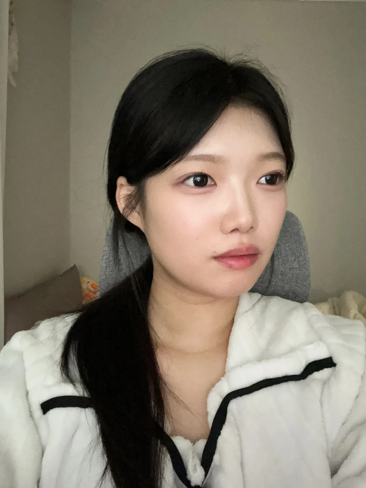 Non-incisional eyelid surgery: first three weeks · Case 048 at Answer Plastic Surgery. Angled view 2 weeks at Answer Plastic Surgery.