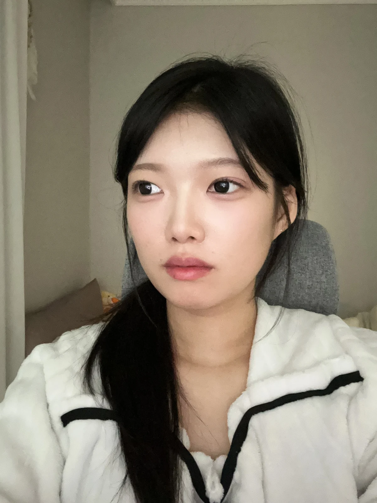 Non-incisional eyelid surgery: first three weeks · Case 048 at Answer Plastic Surgery. Opposite angled view 2 weeks at Answer Plastic Surgery.