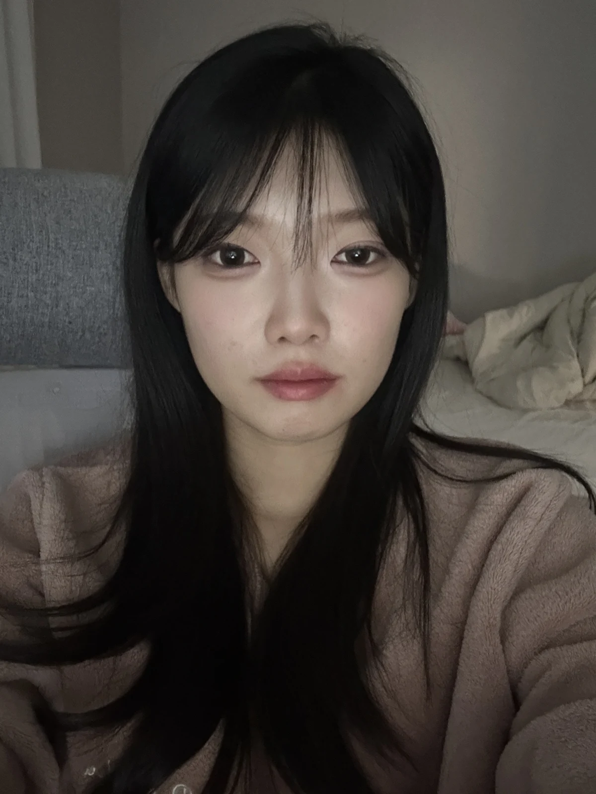 Non-incisional eyelid surgery: first three weeks · Case 048 at Answer Plastic Surgery. Front view 3 weeks at Answer Plastic Surgery.