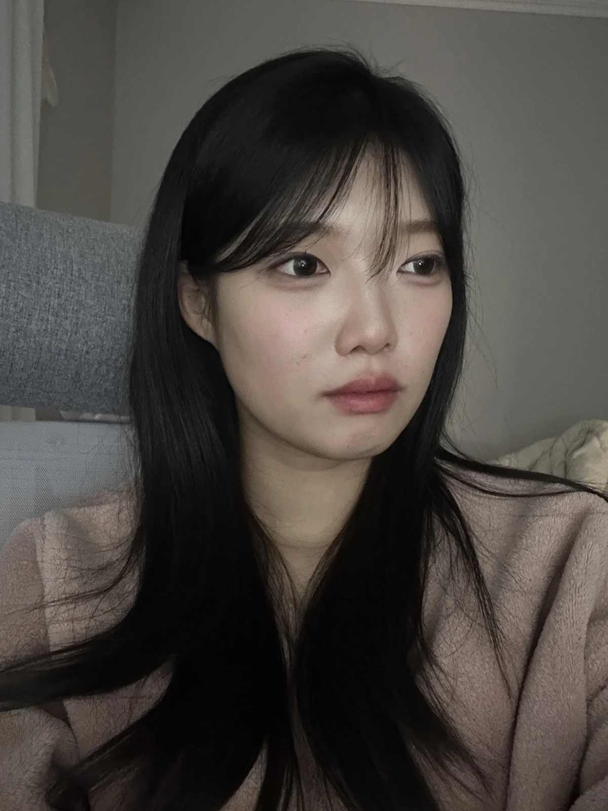 Non-incisional eyelid surgery: first three weeks · Case 048 at Answer Plastic Surgery. Opposite angled view 3 weeks at Answer Plastic Surgery.