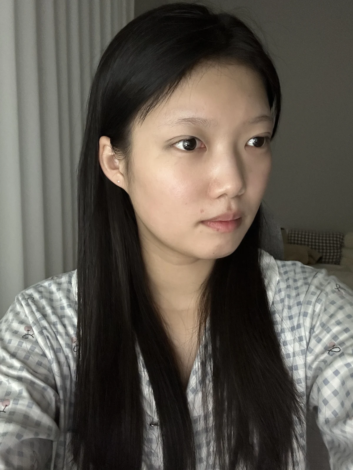 Non-incisional eyelid surgery: first three weeks · Case 048 at Answer Plastic Surgery. Opposite angled view surgery day at Answer Plastic Surgery.