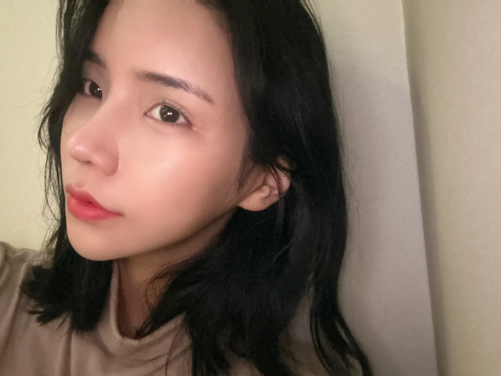 Rhinoplasty and eye surgery: a two-month photo diary · Case 024 at Answer Plastic Surgery. Oblique view after combined surgery — 6 weeks at Answer Plastic Surgery.