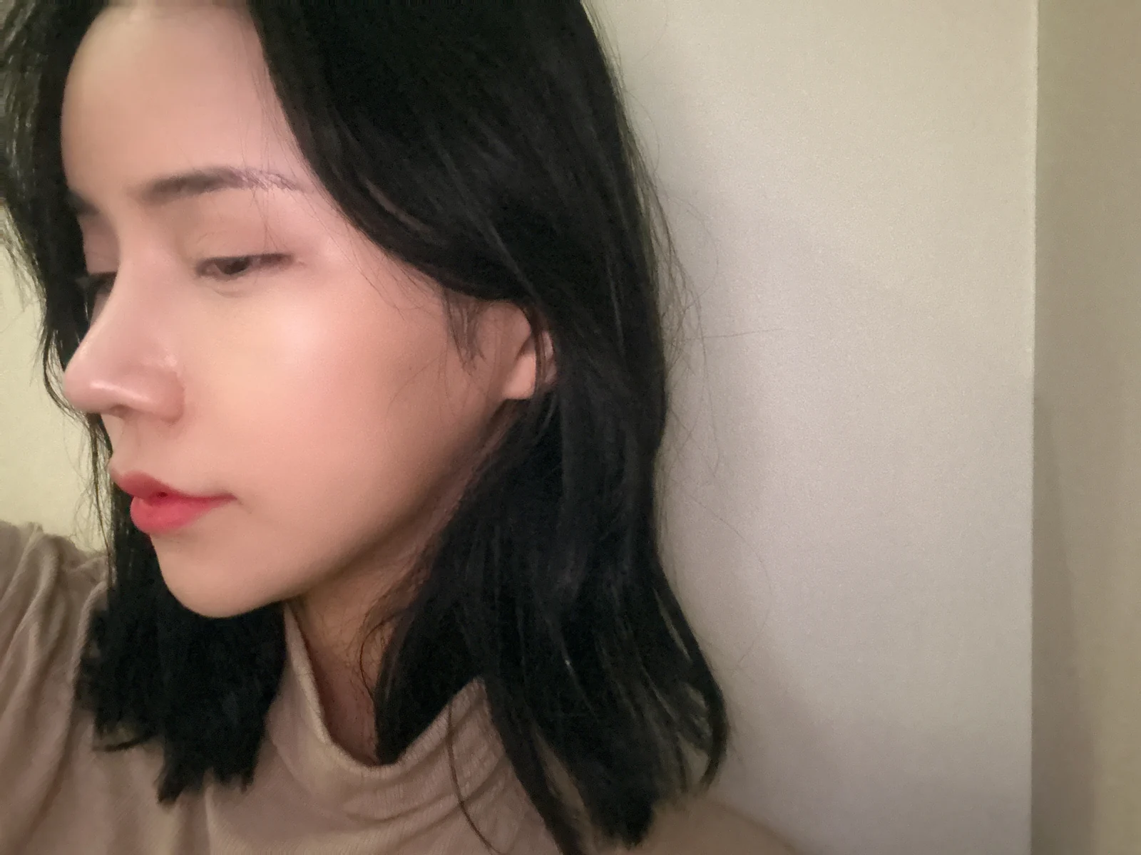 Rhinoplasty and eye surgery: a two-month photo diary · Case 024 at Answer Plastic Surgery. Profile view after combined surgery — 6 weeks at Answer Plastic Surgery.