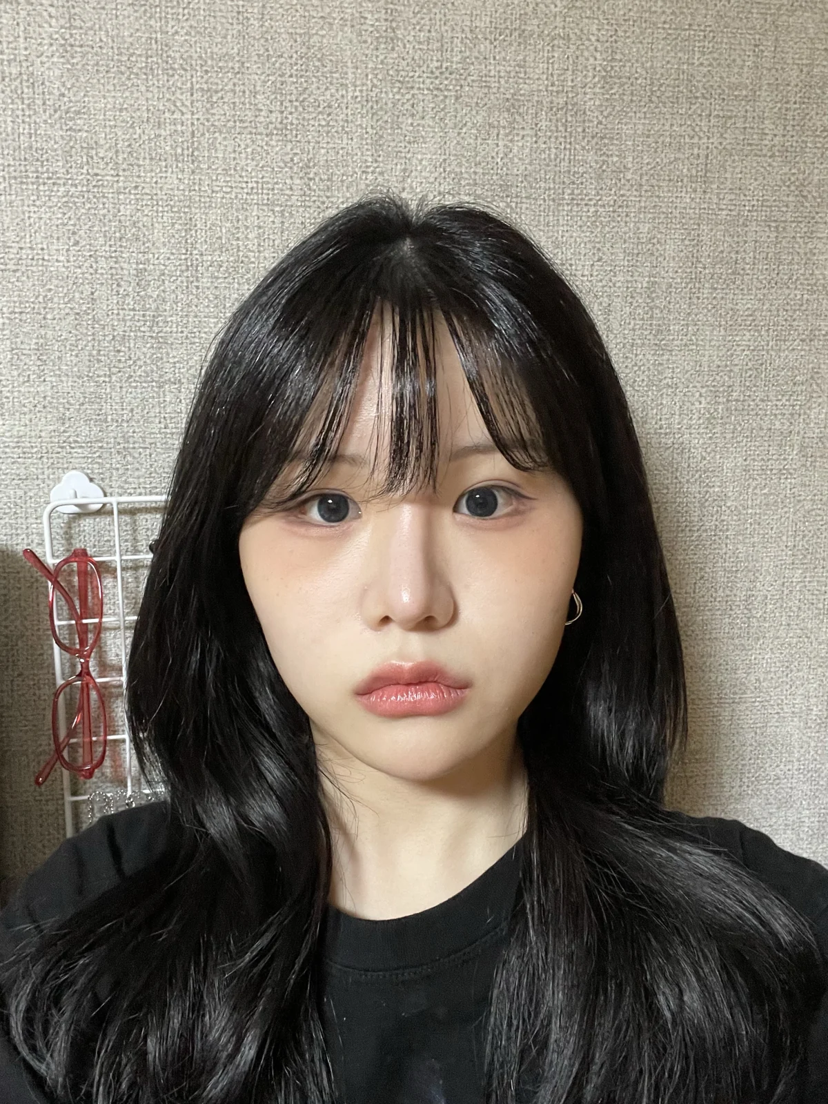Ptosis correction and Wonder canthoplasty: recovery through two months · Case 051 at Answer Plastic Surgery. Front view, 2 months after ptosis correction and Wonder canthoplasty at Answer Plastic Surgery.