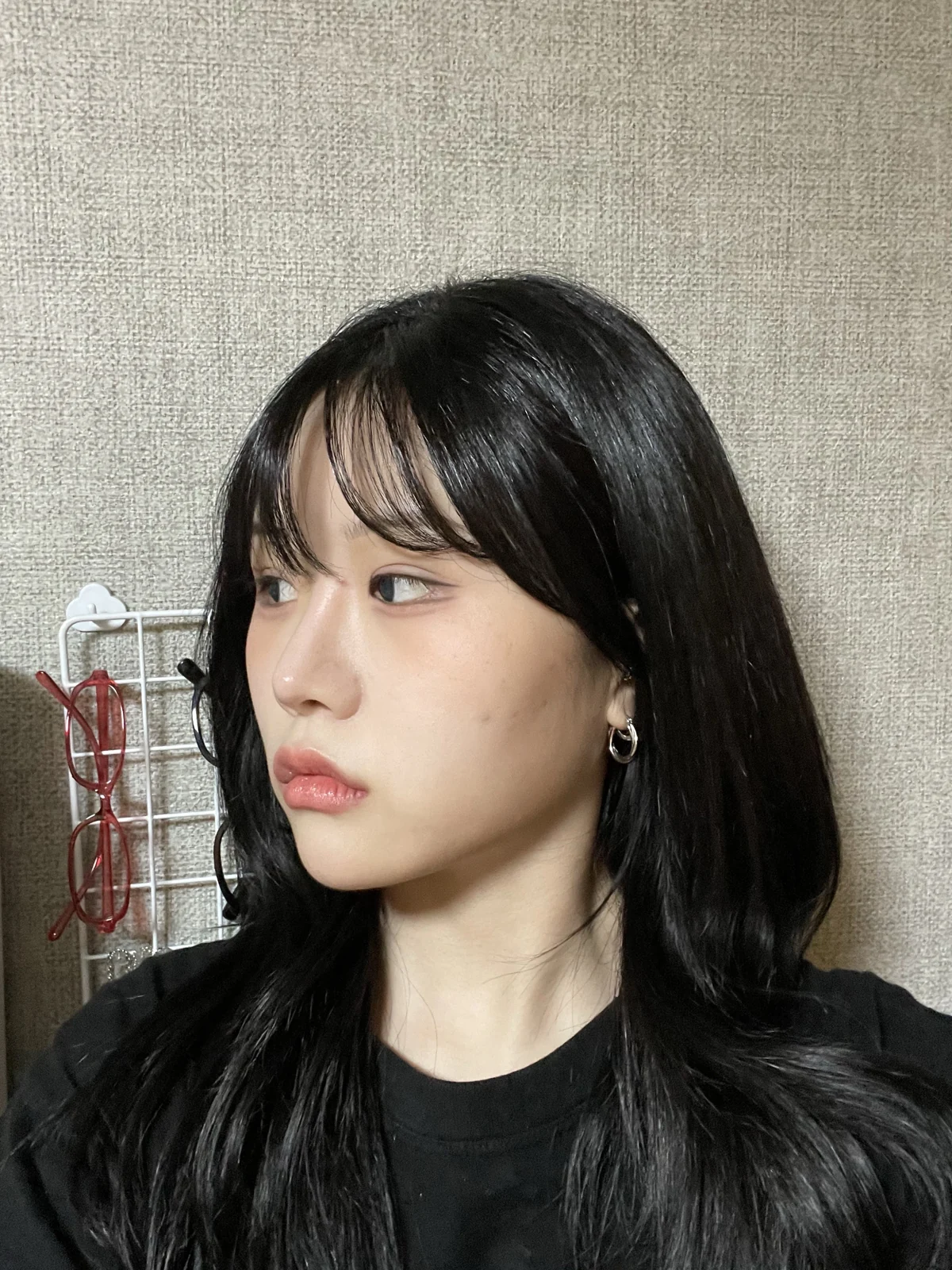Ptosis correction and Wonder canthoplasty: recovery through two months · Case 051 at Answer Plastic Surgery. Angled view facing left, 2 months after ptosis correction and Wonder canthoplasty at Answer Plastic Surgery.