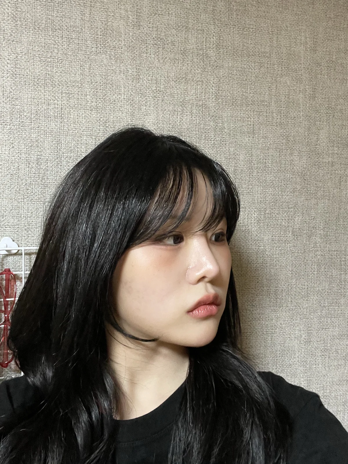 Ptosis correction and Wonder canthoplasty: recovery through two months · Case 051 at Answer Plastic Surgery. Angled view facing right, 2 months after ptosis correction and Wonder canthoplasty at Answer Plastic Surgery.