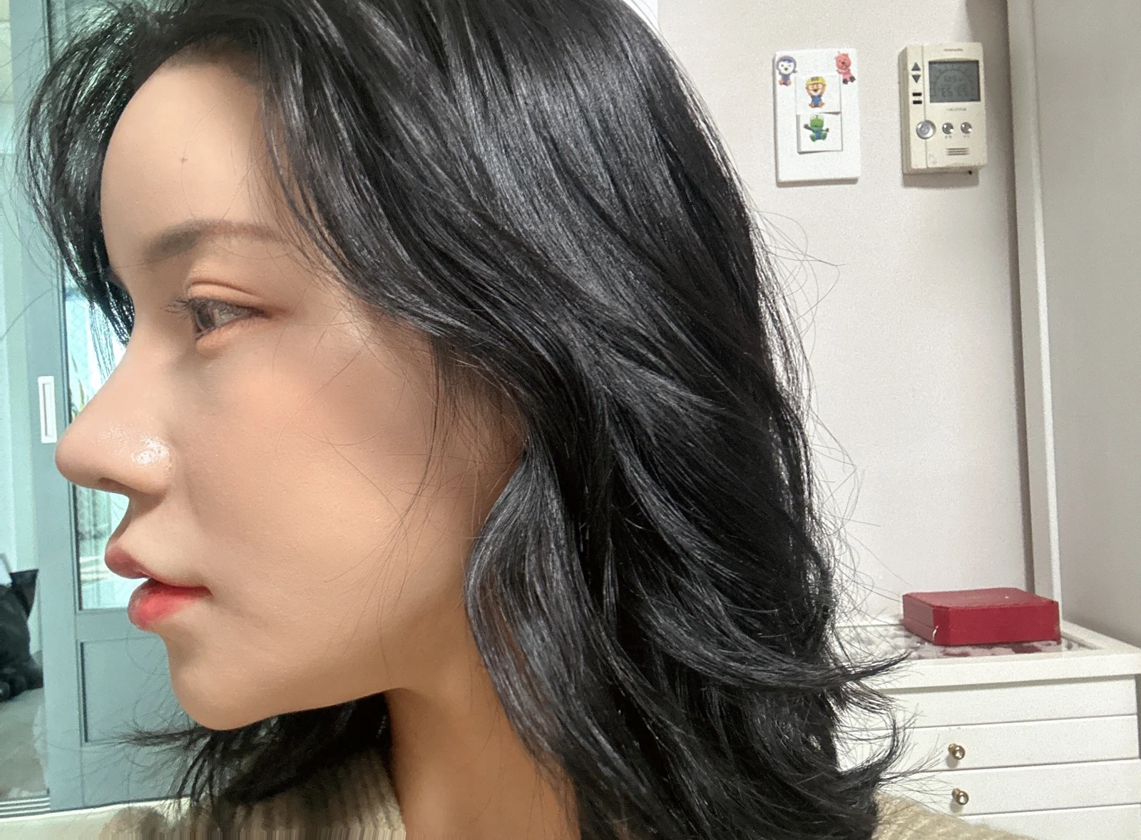 Rhinoplasty and eye surgery: a two-month photo diary · Case 024 at Answer Plastic Surgery. Profile view during early recovery — 1 week at Answer Plastic Surgery.