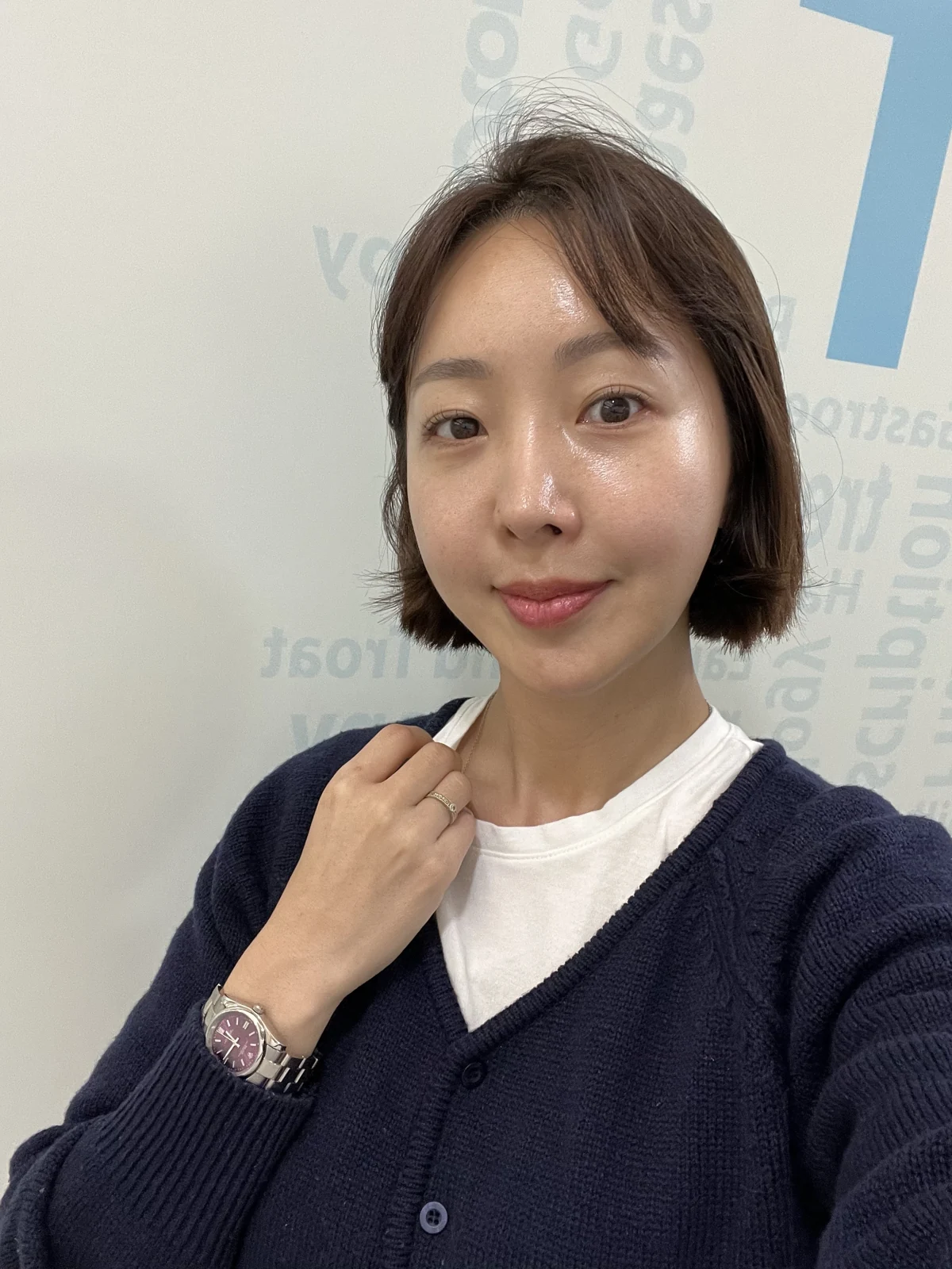 Lateral canthoplasty: recovery from surgery day to six months · Case 040 at Answer Plastic Surgery. Two months: front view of the eye area following the clinic’s case sequence for lateral canthoplasty, ANS-040.