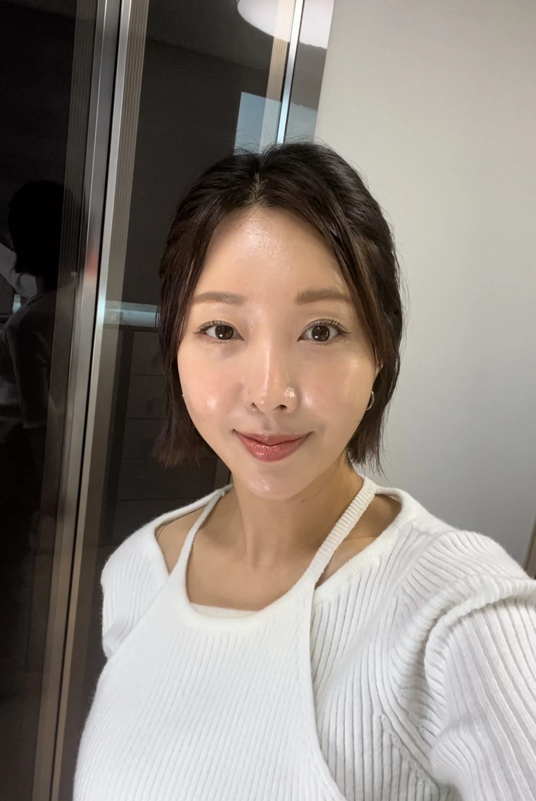 Lateral canthoplasty: recovery from surgery day to six months · Case 040 at Answer Plastic Surgery. Two weeks: front view of the eye area following the clinic’s case sequence for lateral canthoplasty, ANS-040.