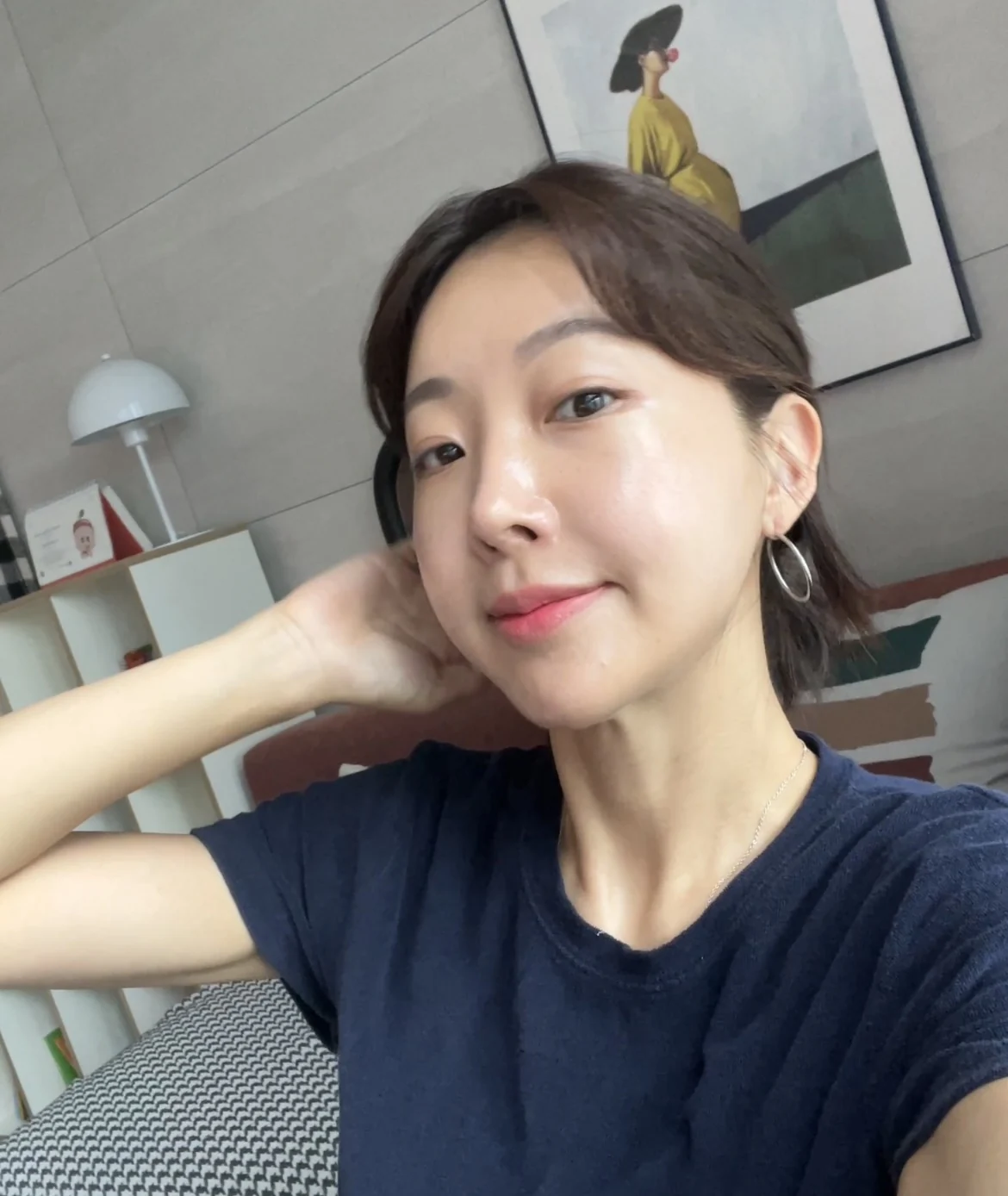 Lateral canthoplasty: recovery from surgery day to six months · Case 040 at Answer Plastic Surgery. Four months: angled view of the eye area following the clinic’s case sequence for lateral canthoplasty, ANS-040.