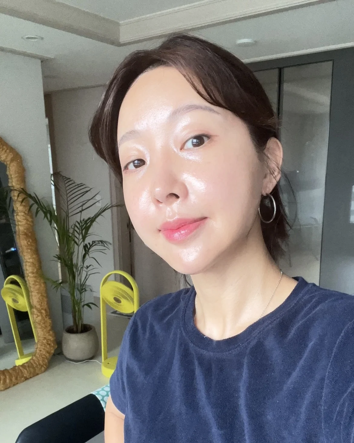 Lateral canthoplasty: recovery from surgery day to six months · Case 040 at Answer Plastic Surgery. Four months: front view of the eye area following the clinic’s case sequence for lateral canthoplasty, ANS-040.