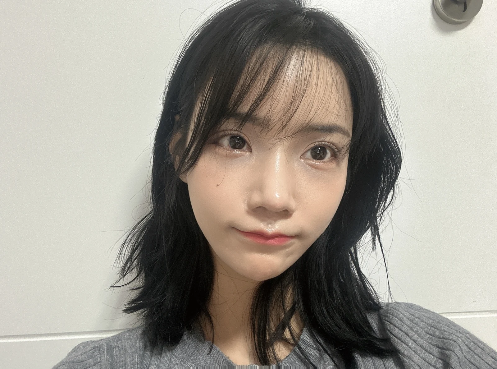 Rhinoplasty and eye surgery: a two-month photo diary · Case 024 at Answer Plastic Surgery. Front view during recovery — 3 weeks at Answer Plastic Surgery.