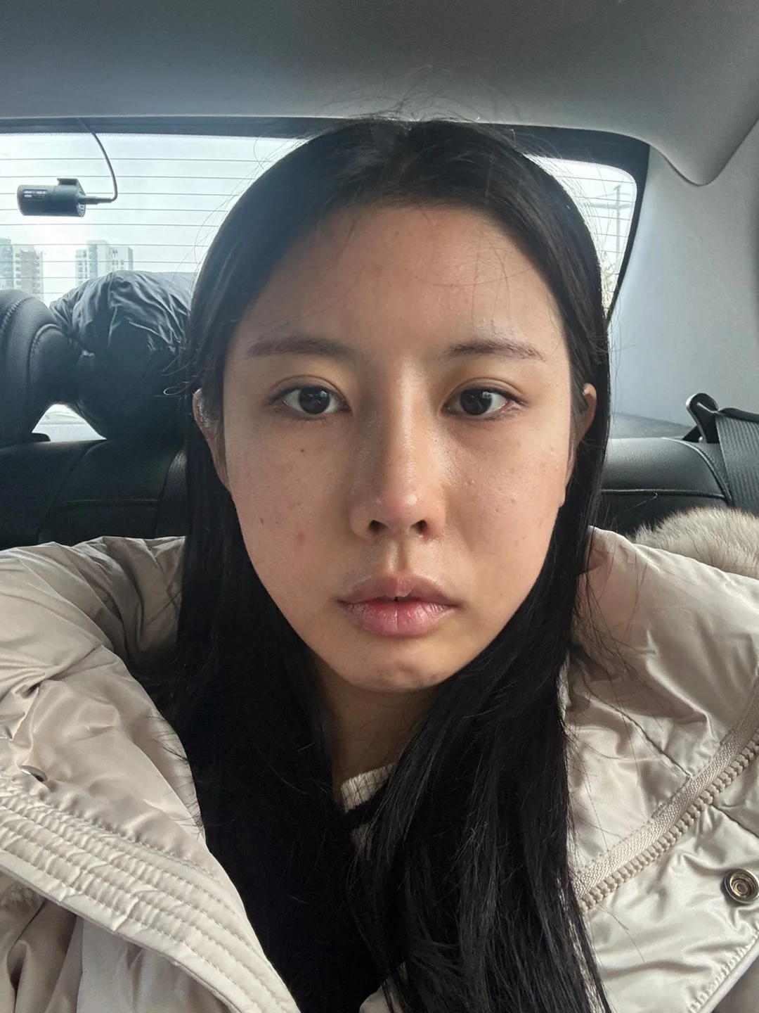 Lateral and lower canthoplasty: the first month · Case 026 at Answer Plastic Surgery. Front view of the eye area — before at Answer Plastic Surgery.