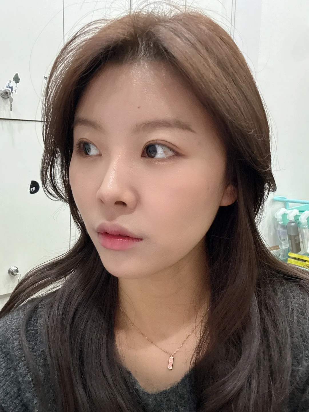 Eye surgery: the first month in photos · Case 027 at Answer Plastic Surgery. Oblique view — 1 month at Answer Plastic Surgery.