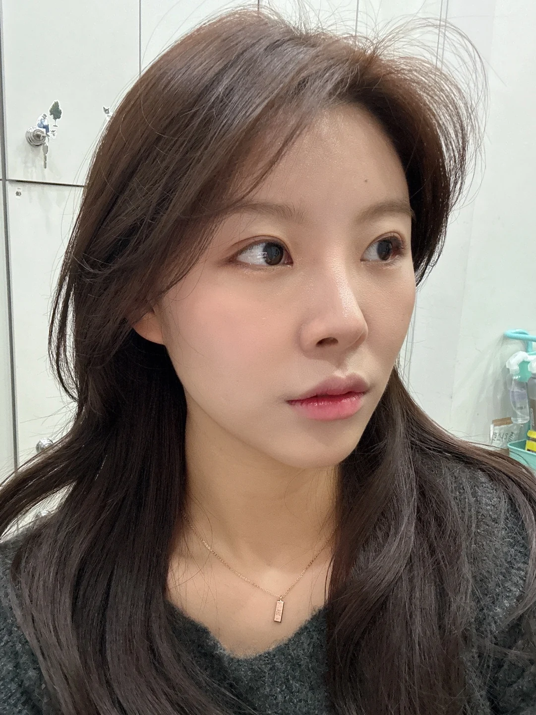 Eye surgery: the first month in photos · Case 027 at Answer Plastic Surgery. Opposite oblique view — 1 month at Answer Plastic Surgery.