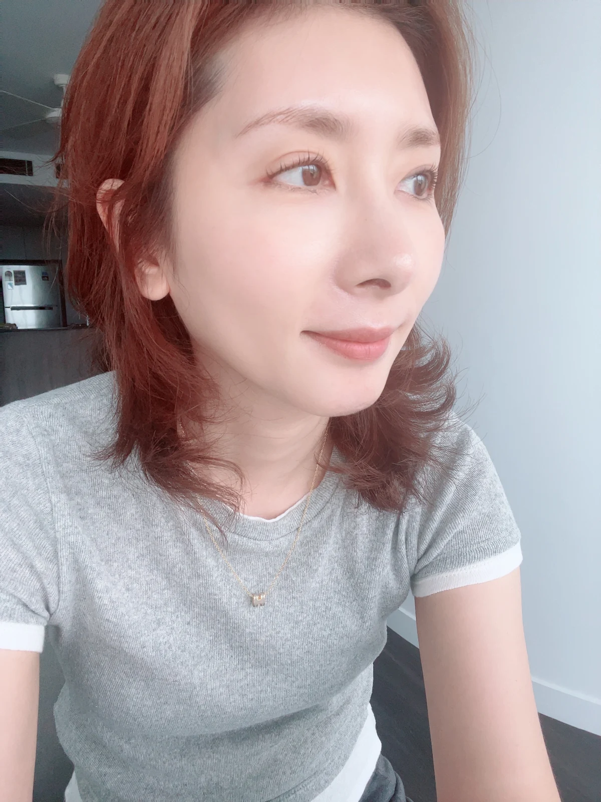 Wonder eye-corner surgery: swelling and appearance over three months · Case 038 at Answer Plastic Surgery. Oblique portrait — 3 months after surgery at Answer Plastic Surgery.
