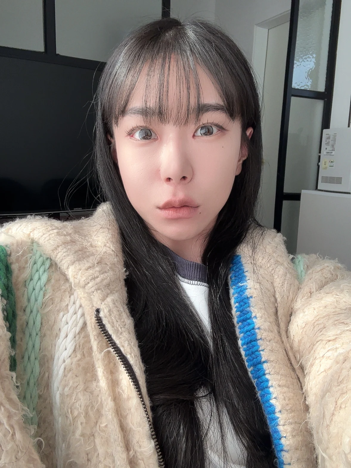 Inner-corner and Wonder eye surgery: the first two weeks · Case 039 at Answer Plastic Surgery. Front portrait — 2 weeks after surgery at Answer Plastic Surgery.