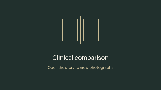 Seong Cell men’s treatment: upright comparison before and after at Cheongdam Cell Clinic