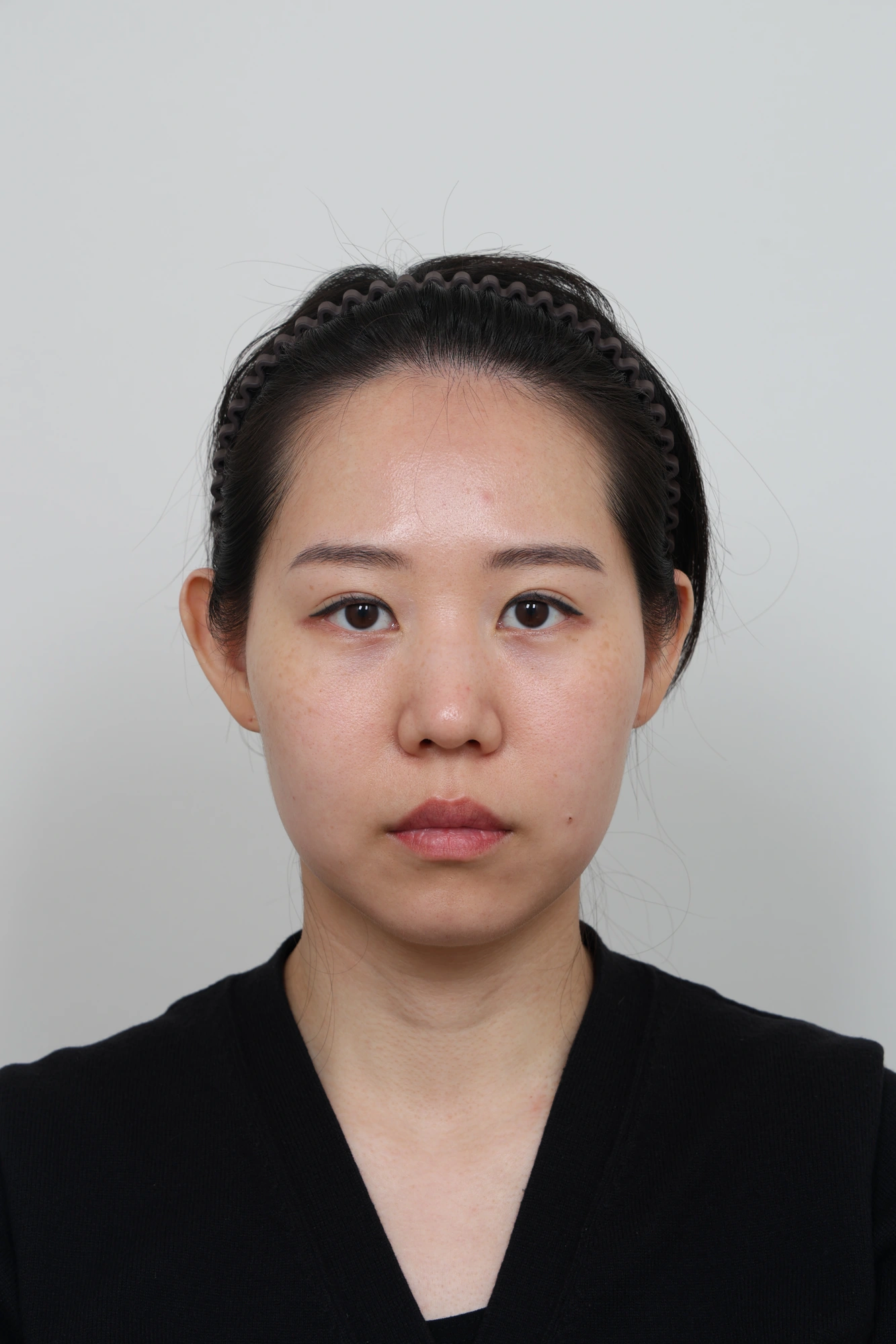 Nose and facial profile — collection 01 at Le J Plastic Surgery Clinic. Le J Clinic, Seoul, collection 01: front view; initial op-folder photograph.