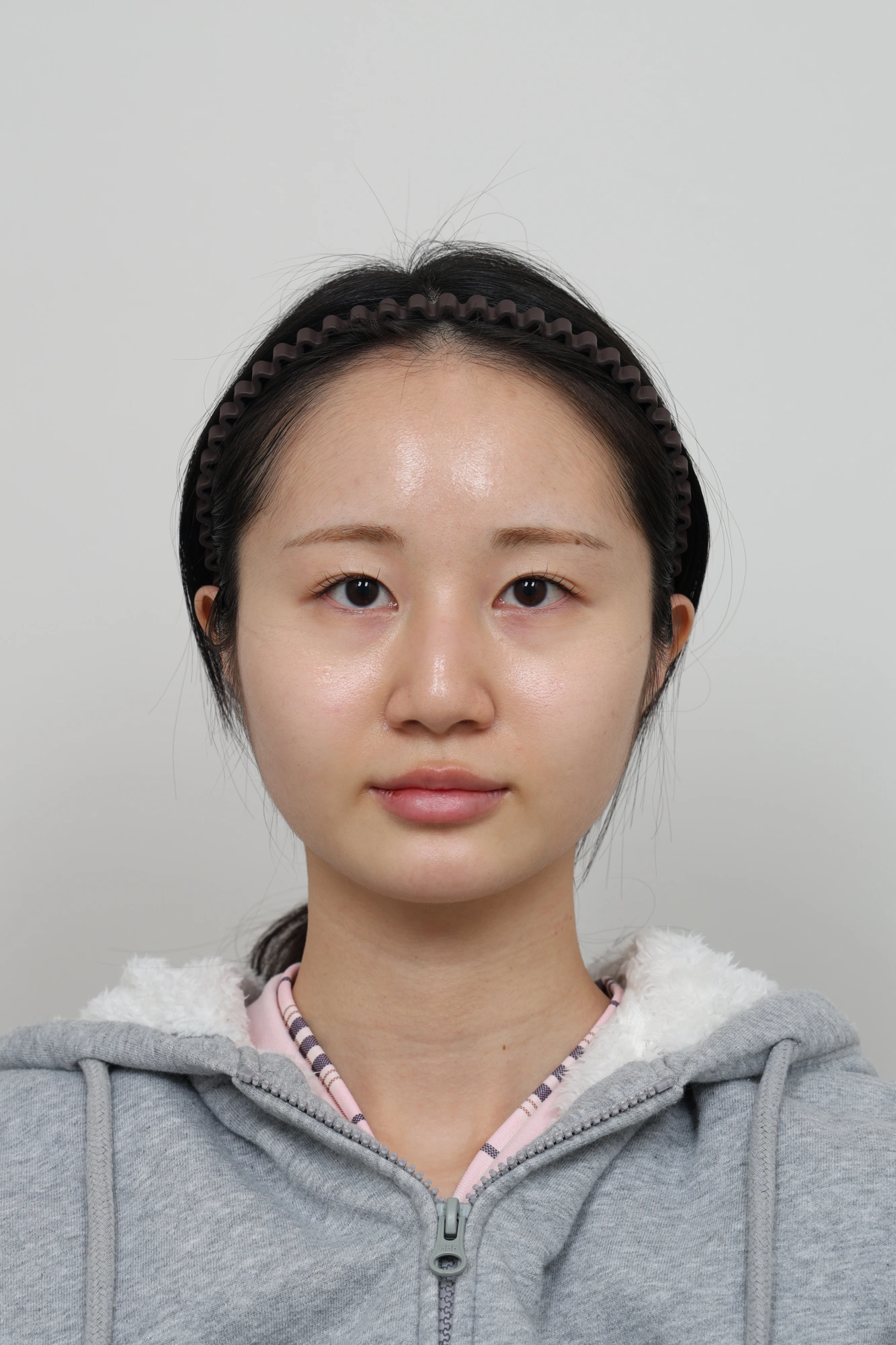 Nose and facial profile — collection 02 at Le J Plastic Surgery Clinic. Le J Clinic, Seoul, collection 02: front view; initial op-folder photograph.