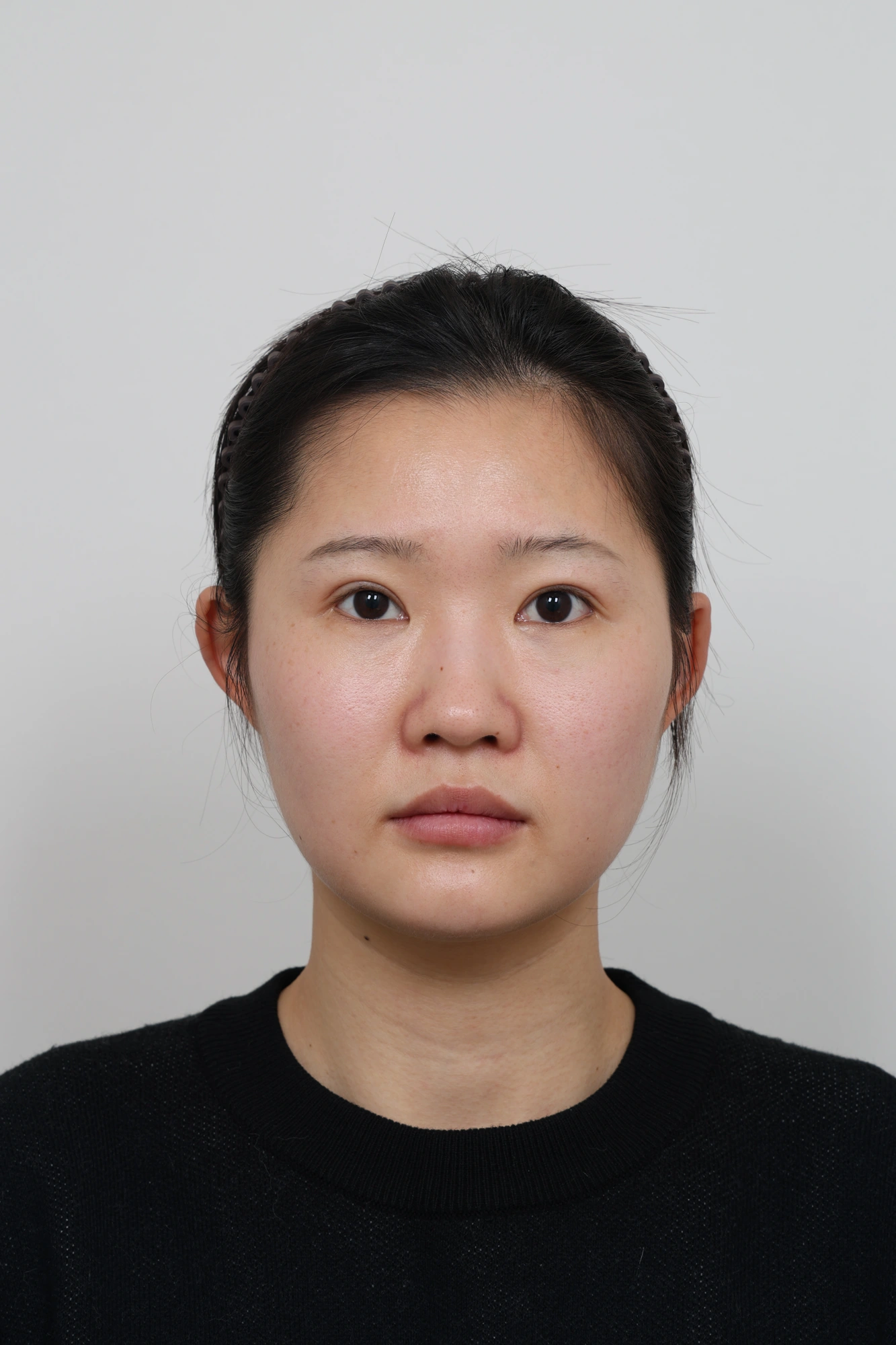 Nose and facial profile — collection 04 at Le J Plastic Surgery Clinic. Le J Clinic, Seoul, collection 04: front view; initial op-folder photograph.