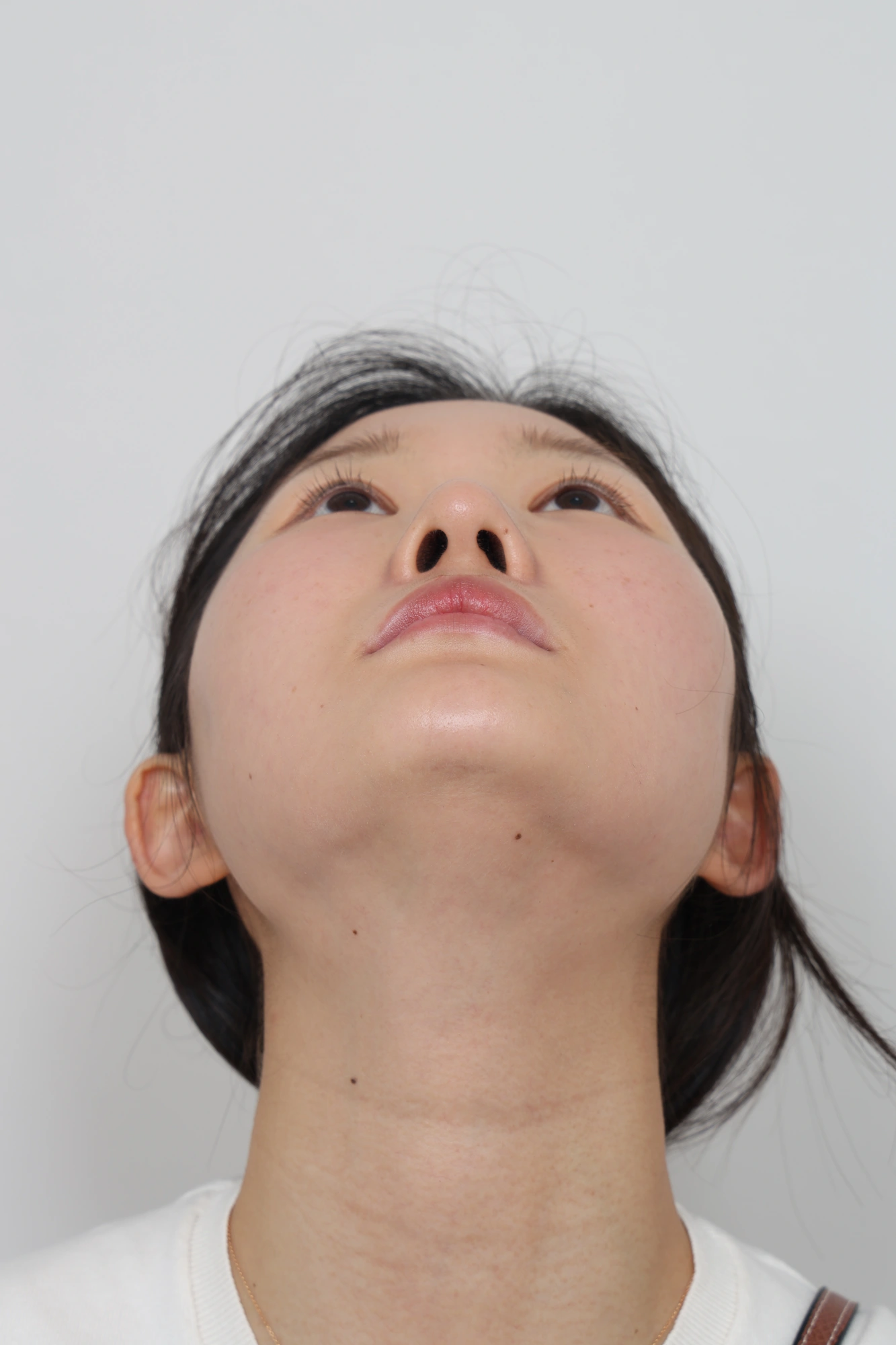 Nose and facial profile — collection 04 at Le J Plastic Surgery Clinic. Le J Clinic, Seoul, collection 04: upward view of the nose and nostrils; source folder labelled 3 months.