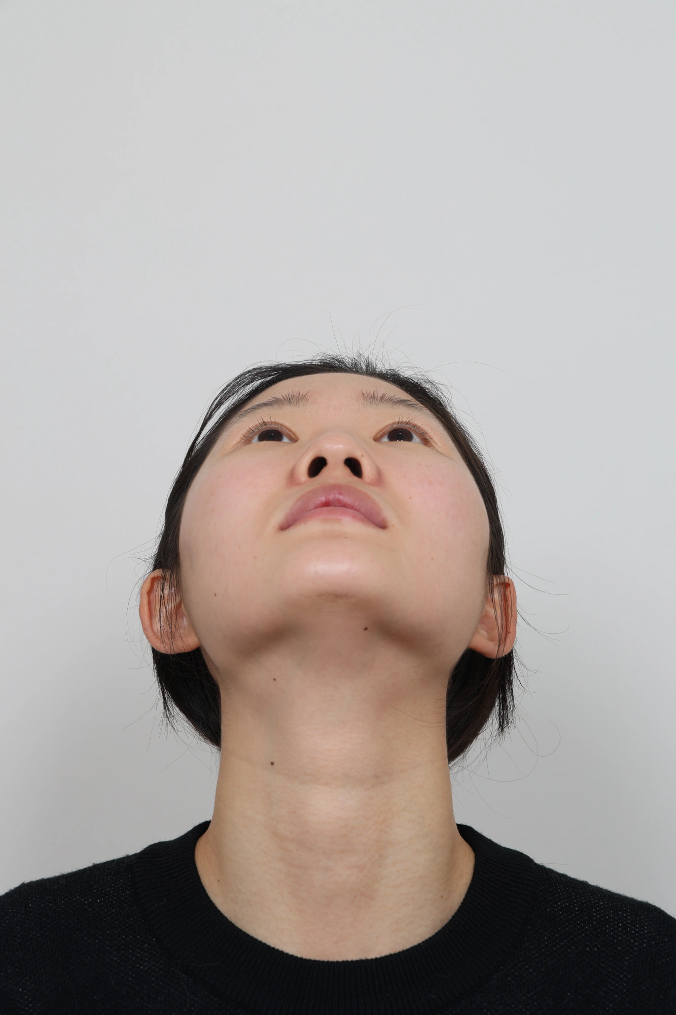 Nose and facial profile — collection 04 at Le J Plastic Surgery Clinic. Le J Clinic, Seoul, collection 04: upward view of the nose and nostrils; initial op-folder photograph.