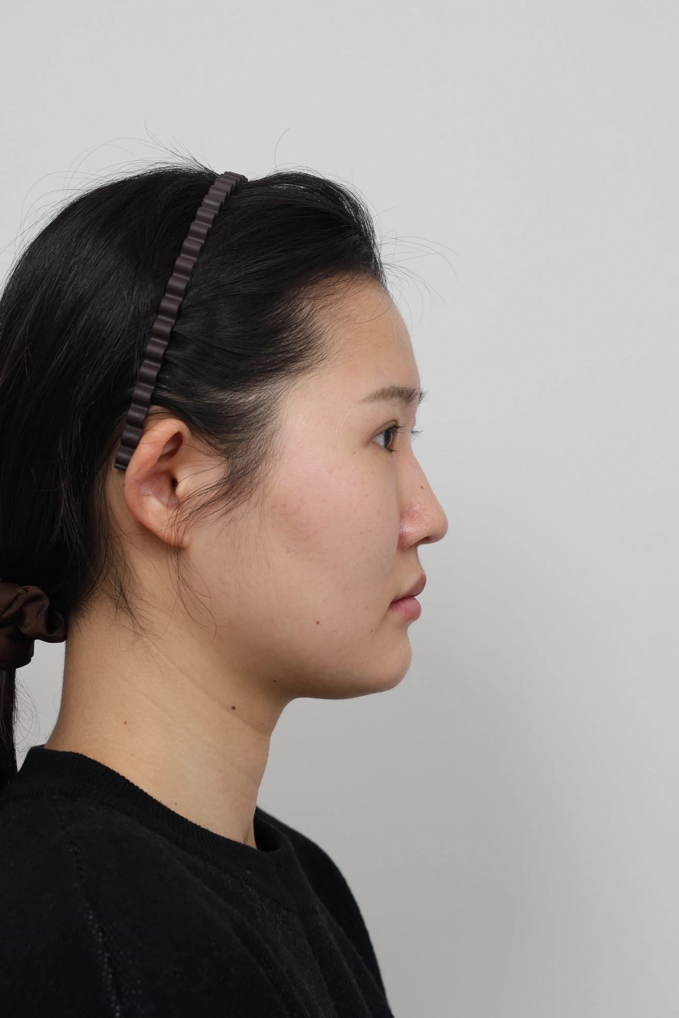 Nose and facial profile — collection 04 at Le J Plastic Surgery Clinic. Le J Clinic, Seoul, collection 04: side view; initial op-folder photograph.