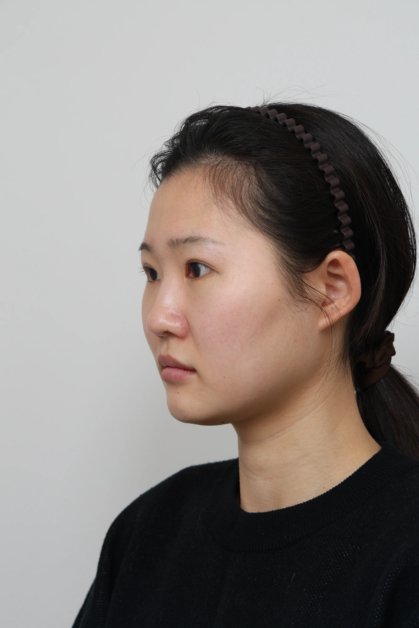 Nose and facial profile — collection 04 at Le J Plastic Surgery Clinic. Le J Clinic, Seoul, collection 04: opposite angled view; initial op-folder photograph.